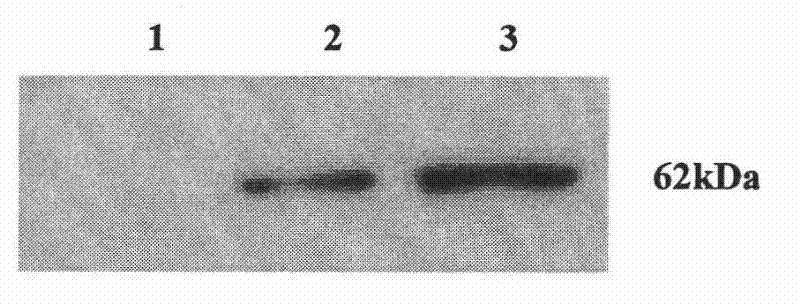 A kind of human cytomegalovirus ul49 gene antigen peptide, its antibody and application