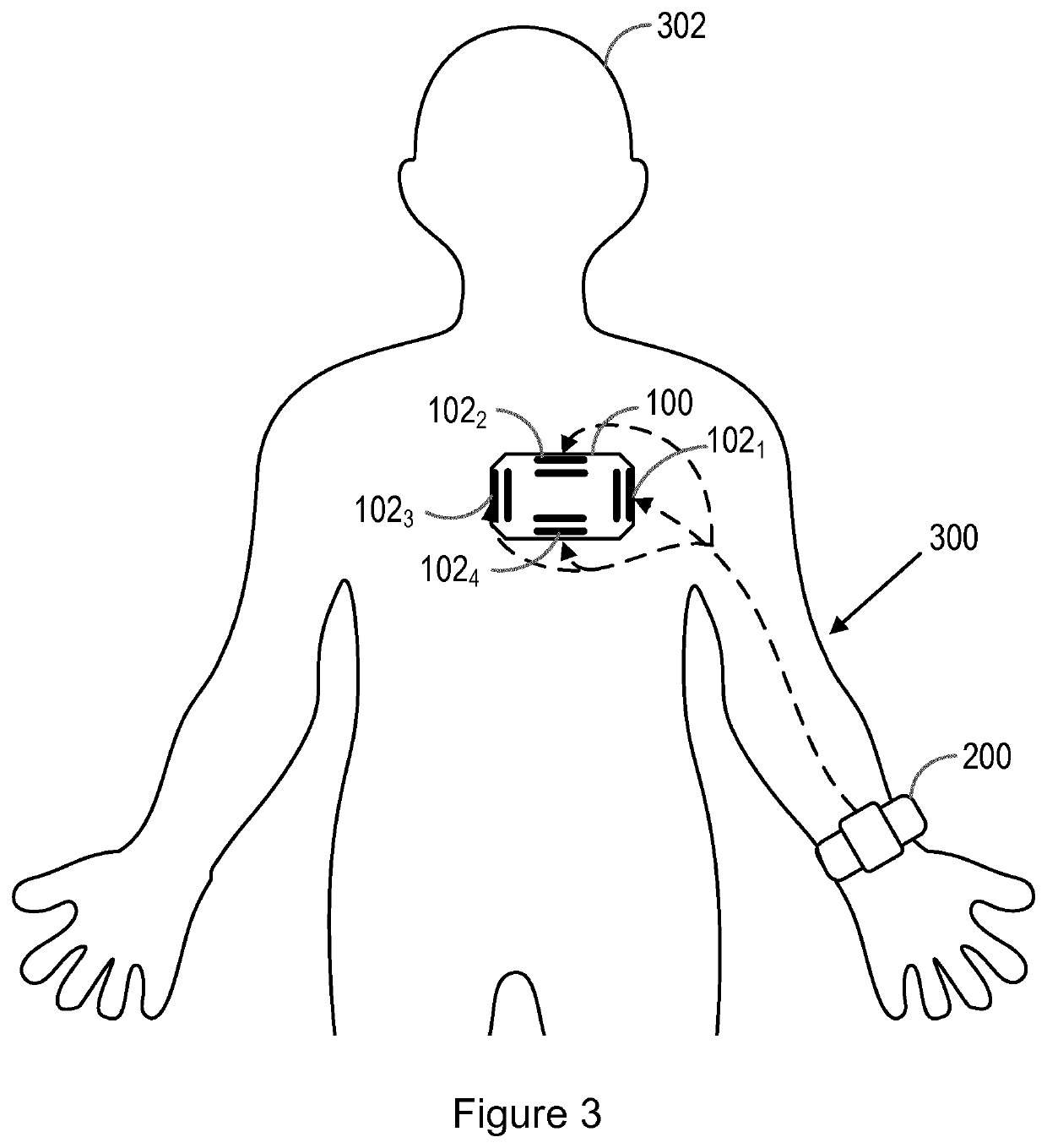 Determining an orientation of a wearable device