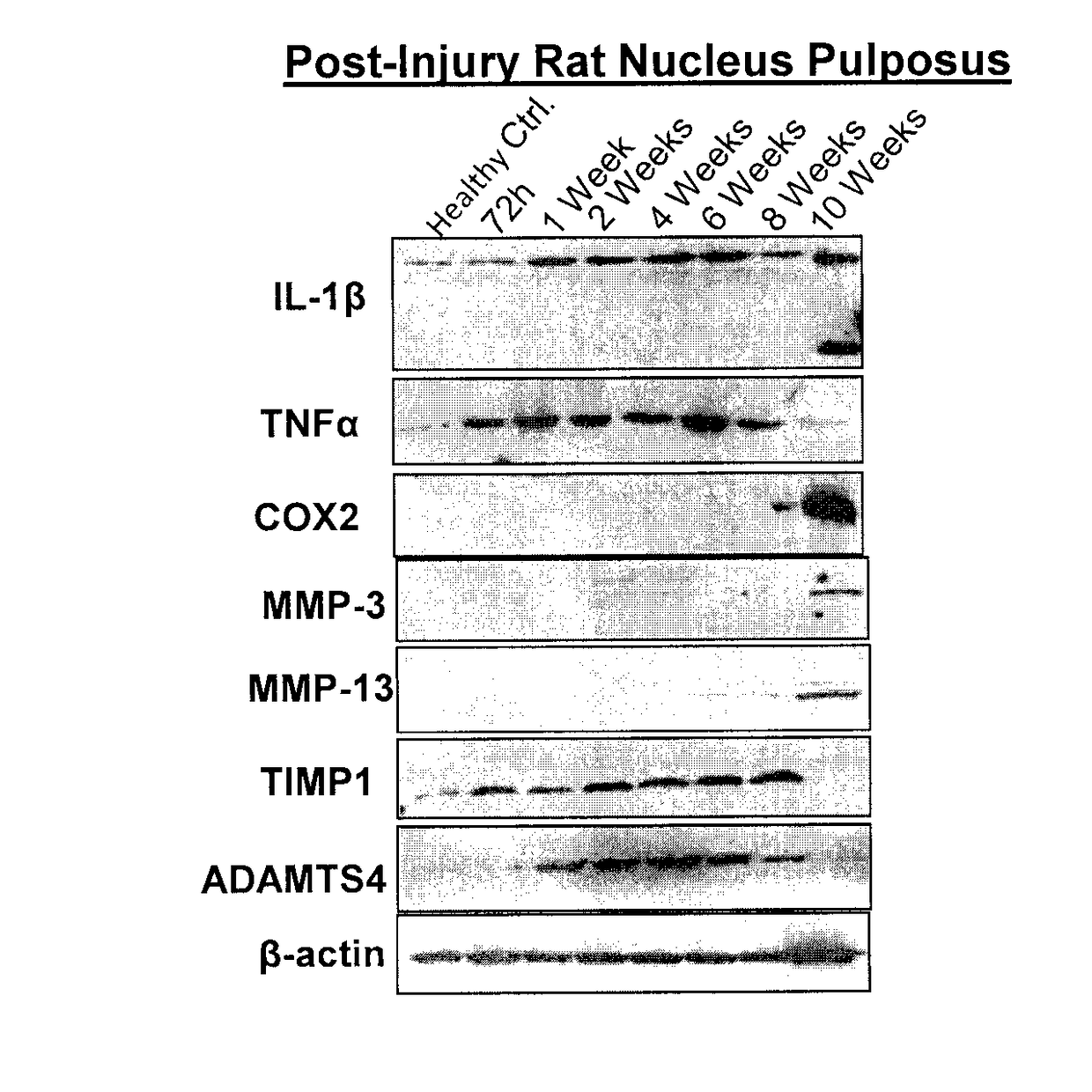 Compositions and methods comprising growth factors, chondroitin and glucosamine for degenerative disc regeneration