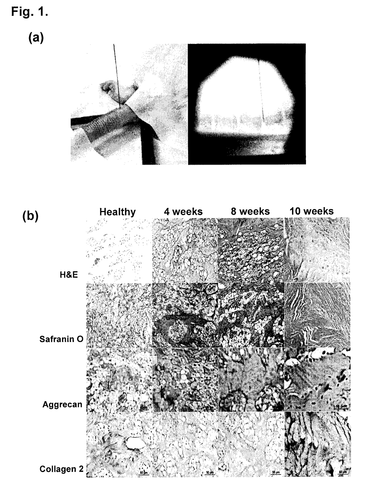 Compositions and methods comprising growth factors, chondroitin and glucosamine for degenerative disc regeneration