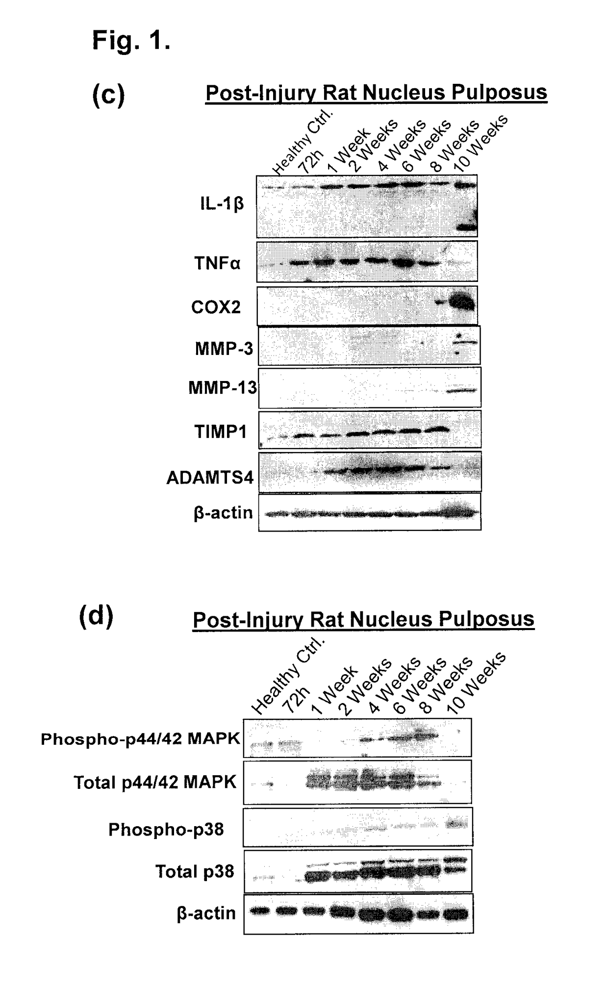 Compositions and methods comprising growth factors, chondroitin and glucosamine for degenerative disc regeneration