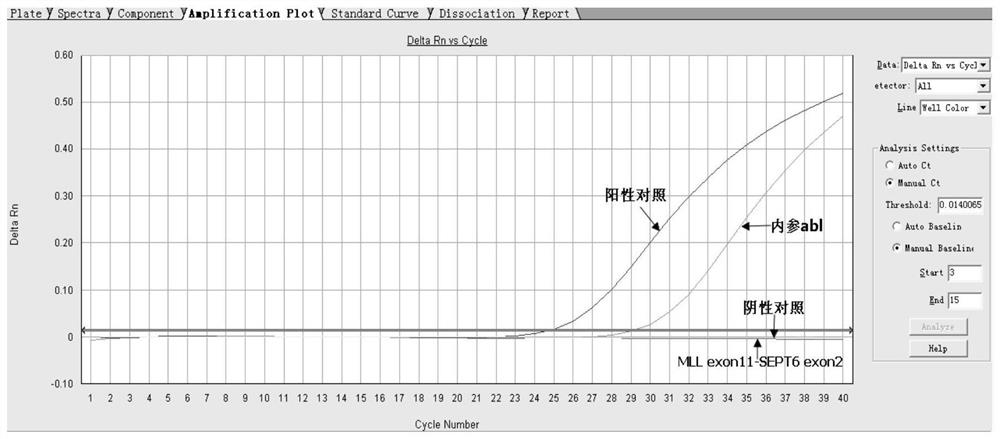 Primers, probes and methods for screening leukemia mll-sept6 fusion gene by real-time fluorescent PCR