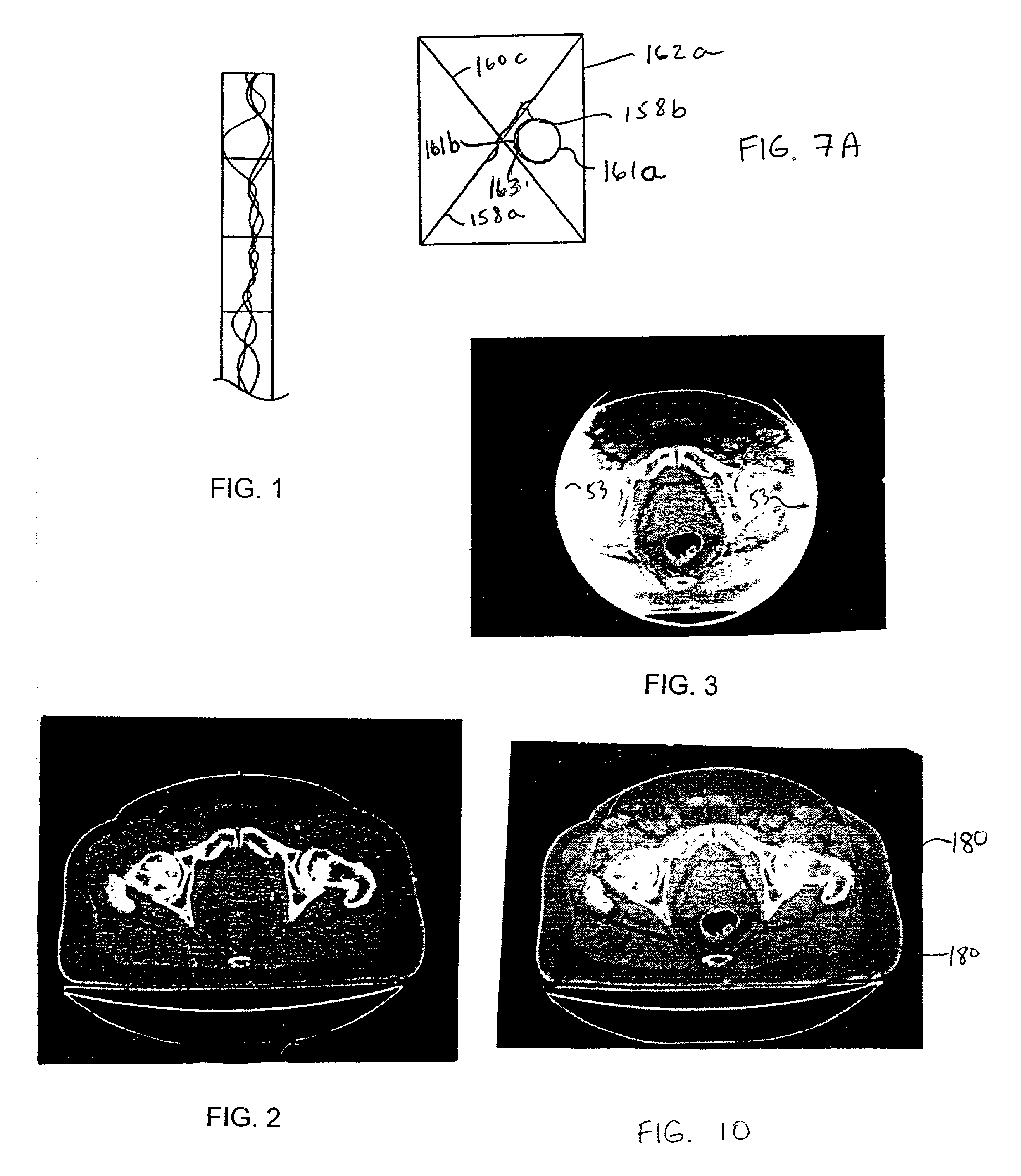 System and method for fusion-aligned reprojection of incomplete data
