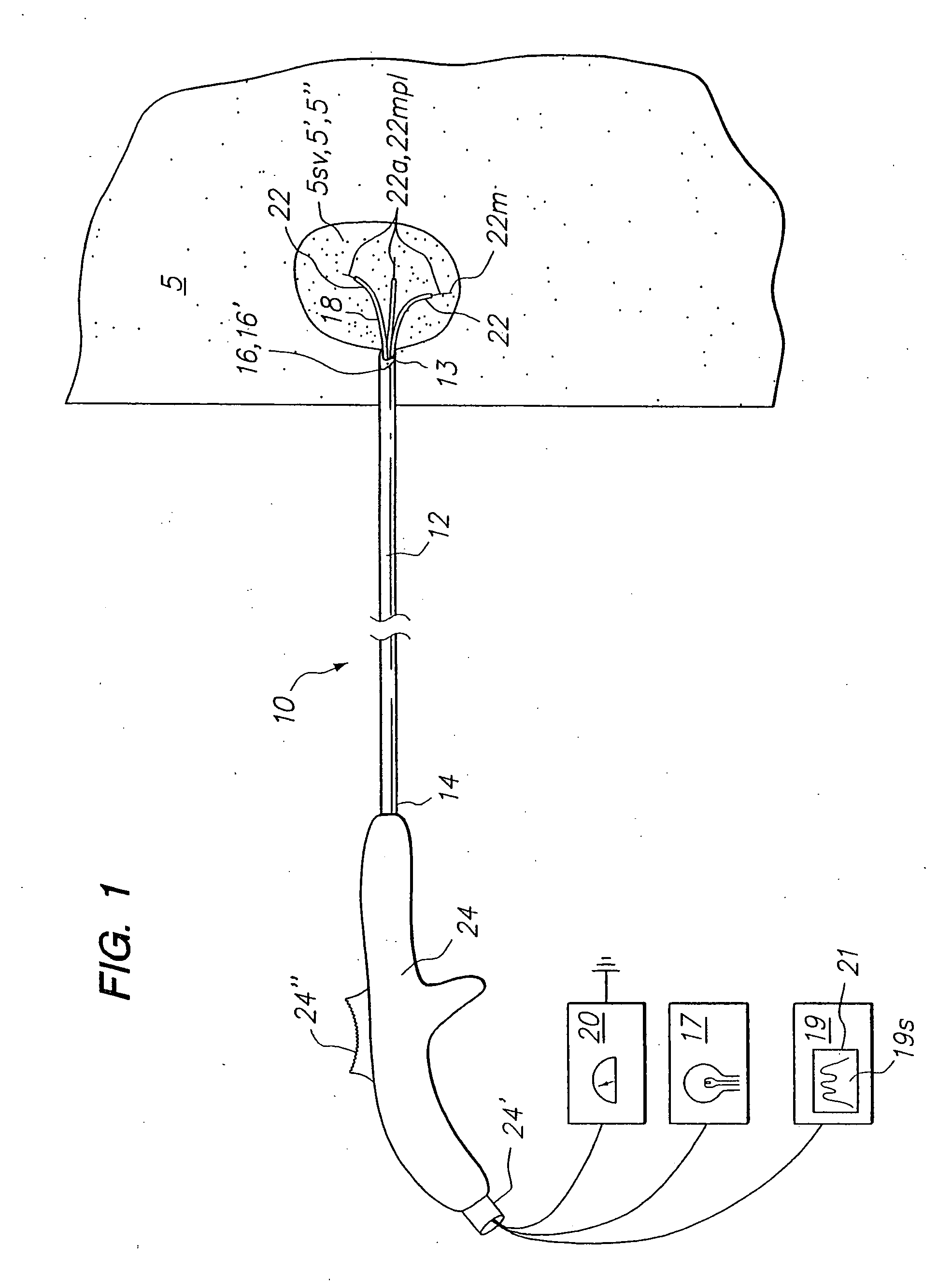 Tissue biopsy and treatment apparatus and method