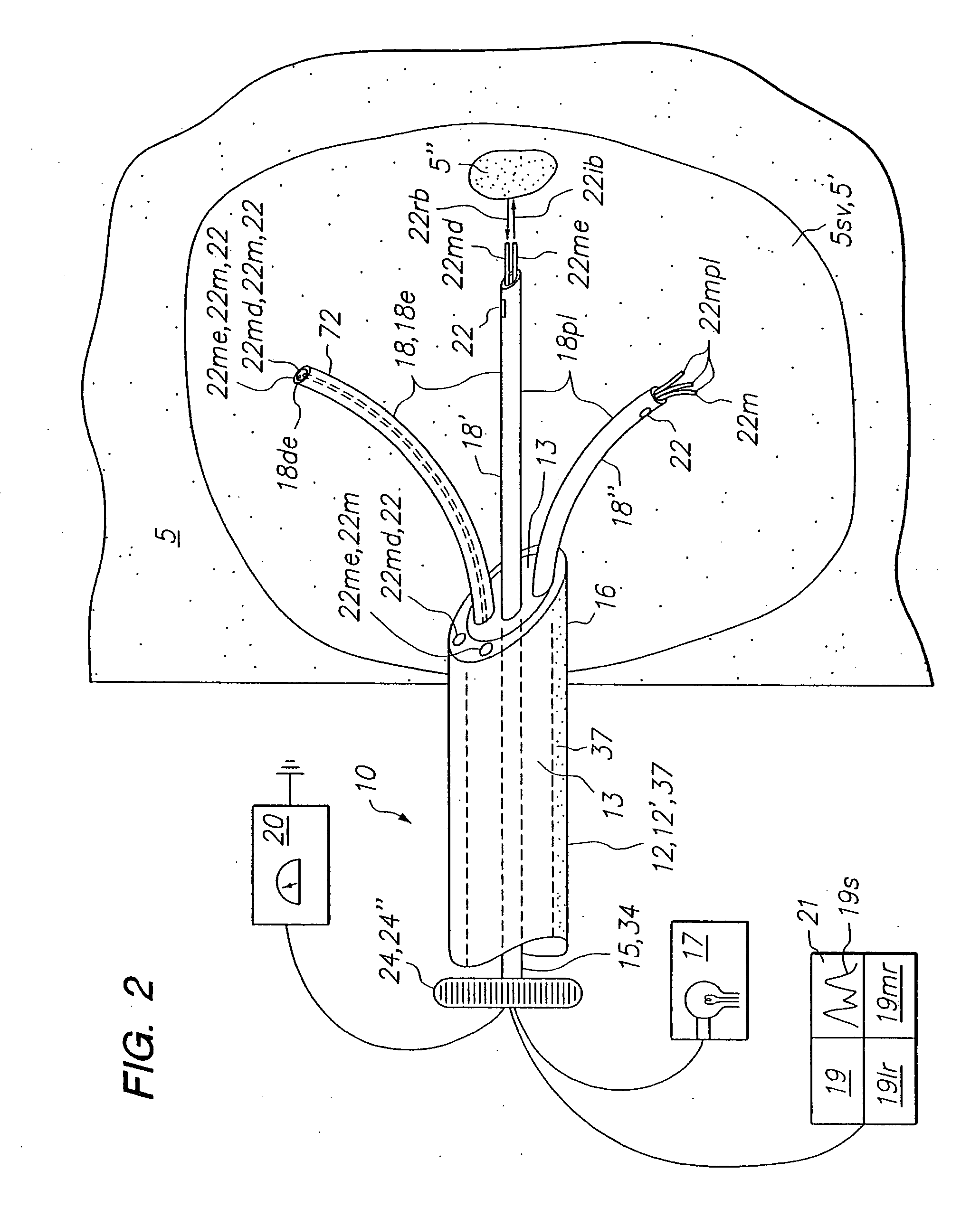 Tissue biopsy and treatment apparatus and method