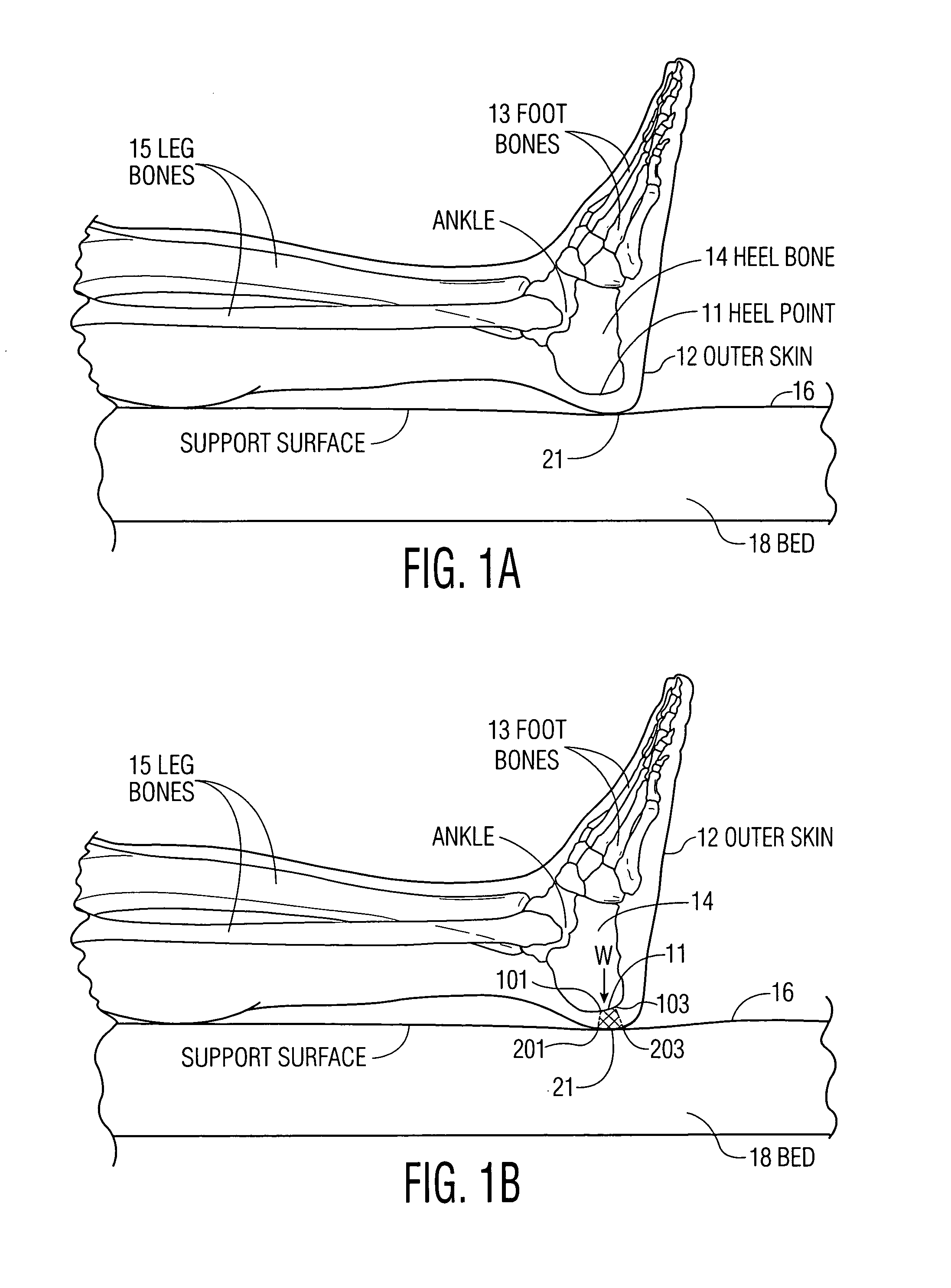 Apparatus and methods for preventing and/or healing pressure ulcers