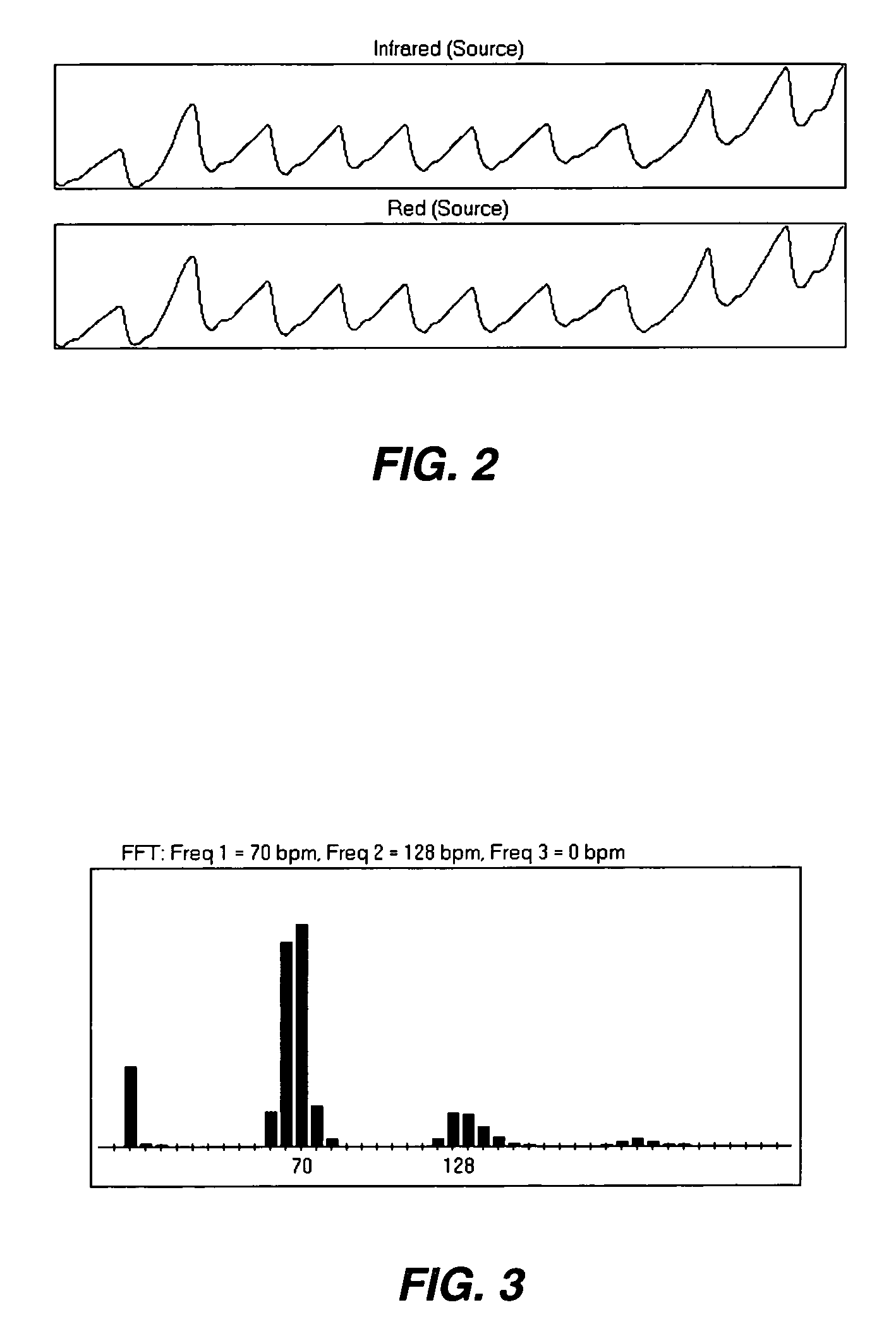 Method, apparatus, and system for removing motion artifacts from measurements of bodily parameters