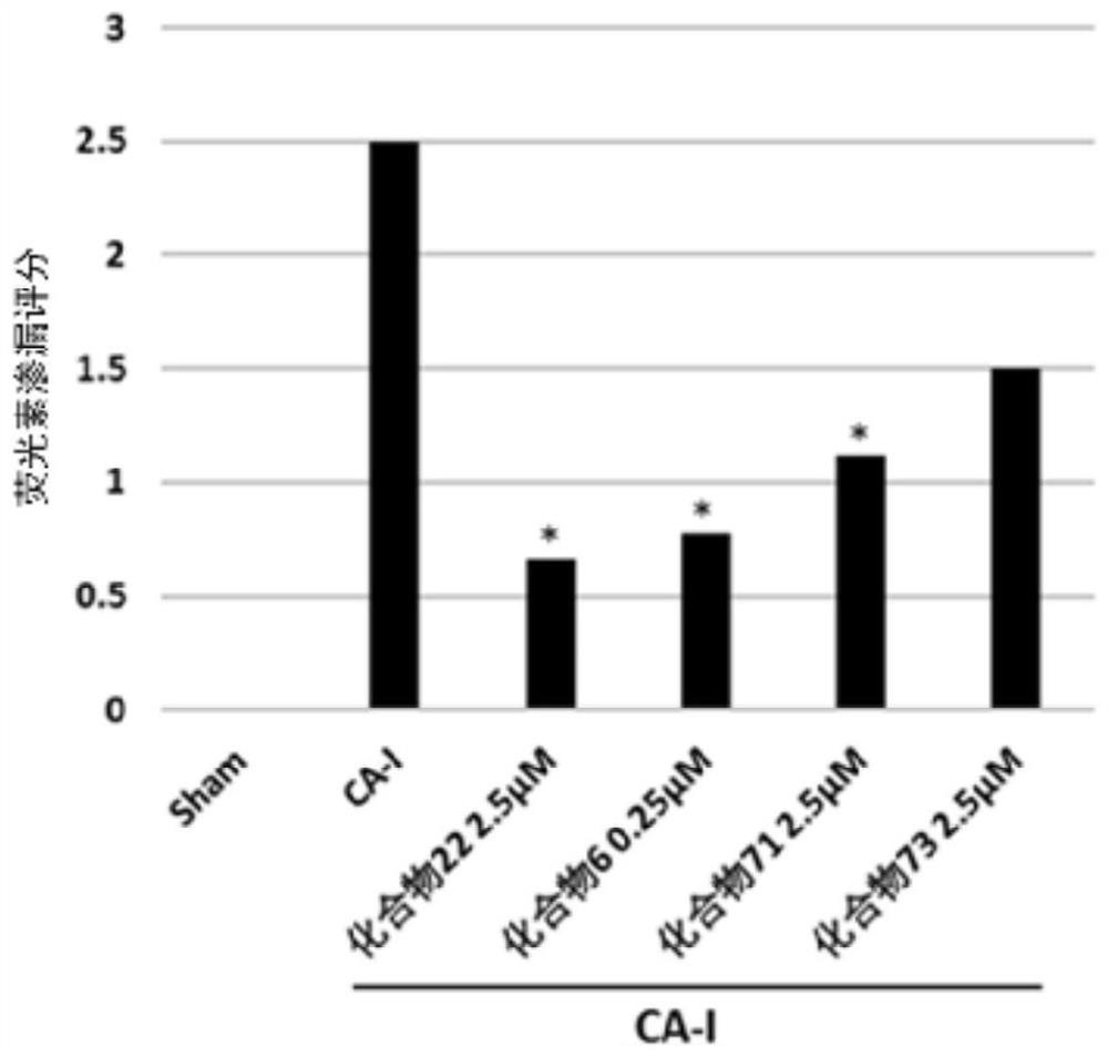 Tricyclic compound as plasma kallikrein inhibitor and application thereof