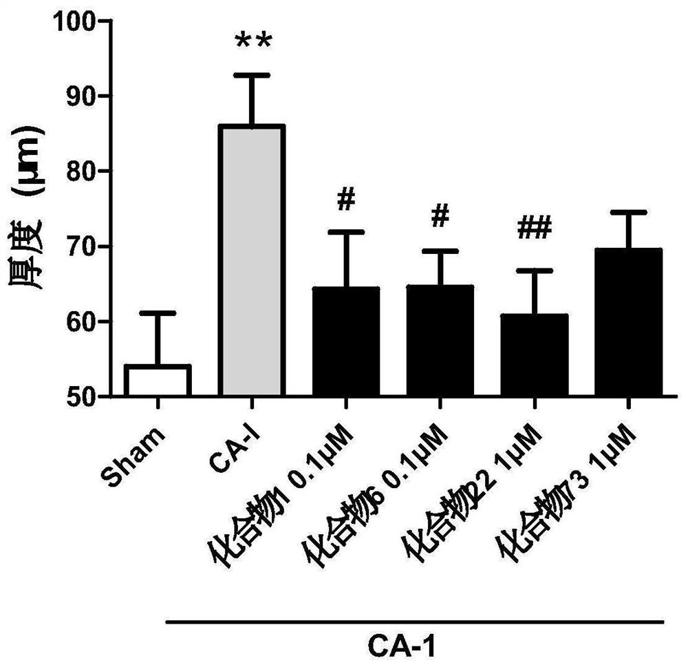 Tricyclic compound as plasma kallikrein inhibitor and application thereof