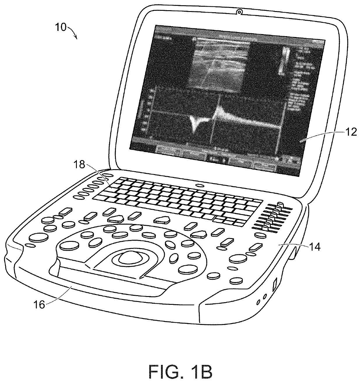 Devices and Methods for Ultrasound Monitoring
