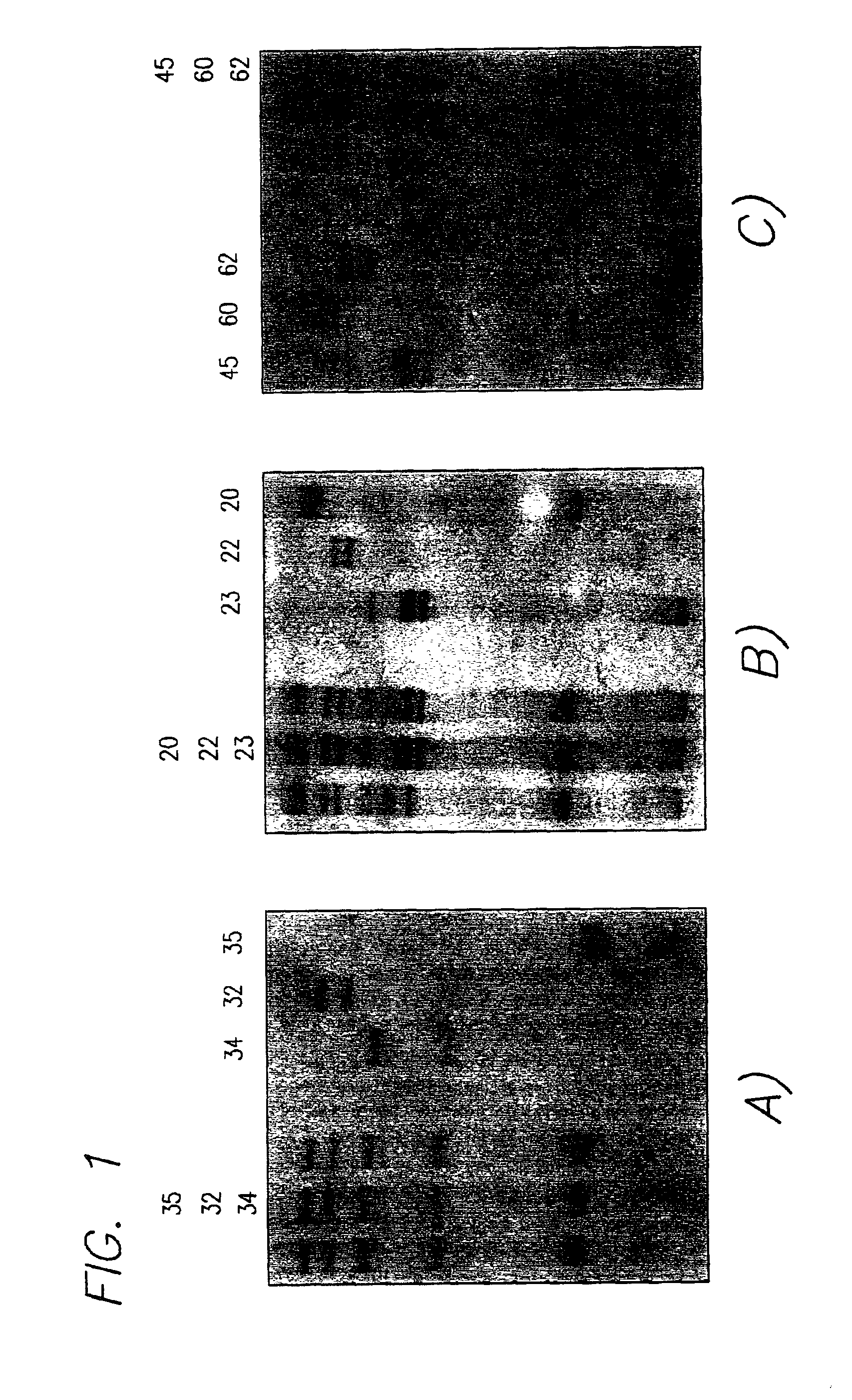 Methods for detection of ataxia telangiectasia mutations