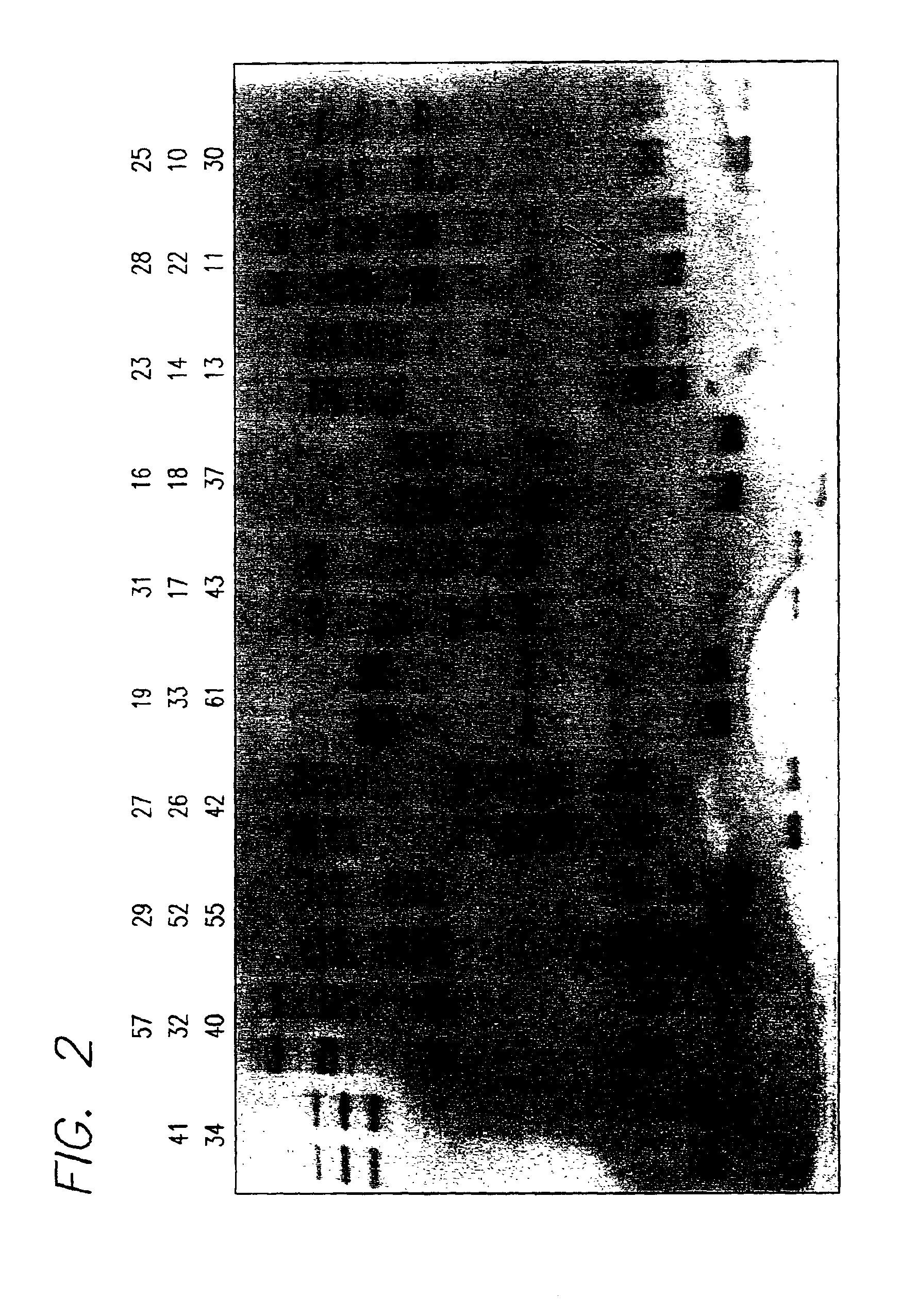 Methods for detection of ataxia telangiectasia mutations