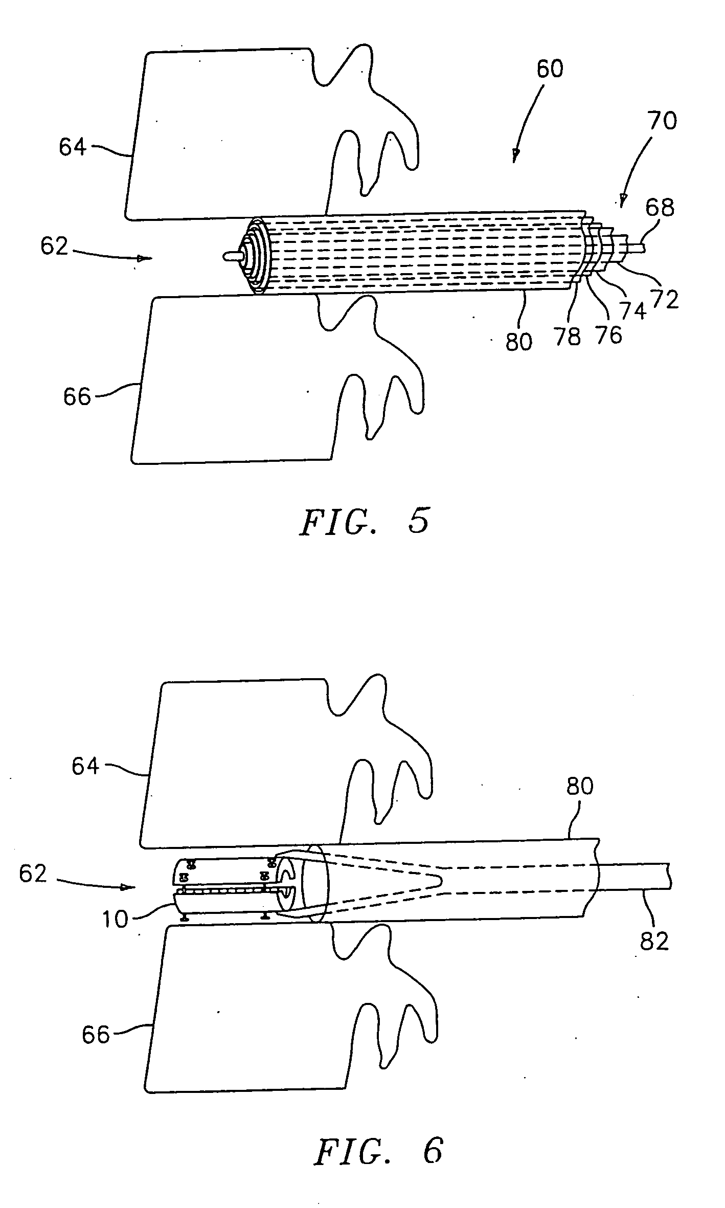 Device and method for lumbar interbody fusion