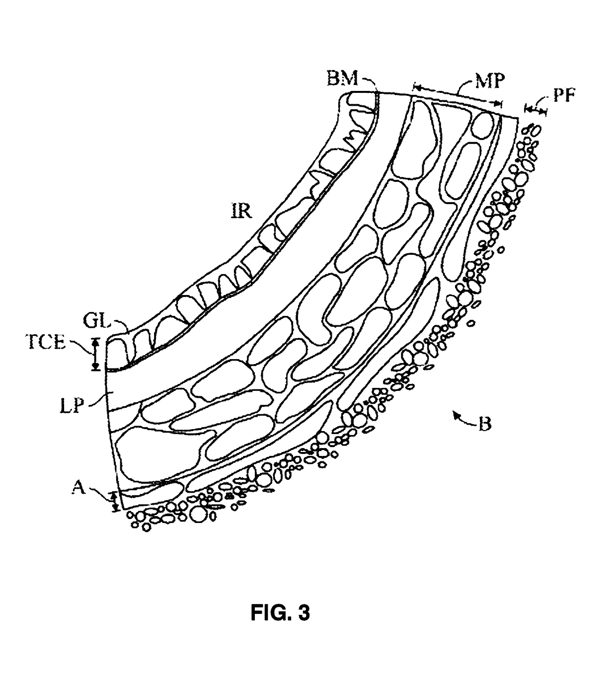 Methods and devices for treating pelvic conditions