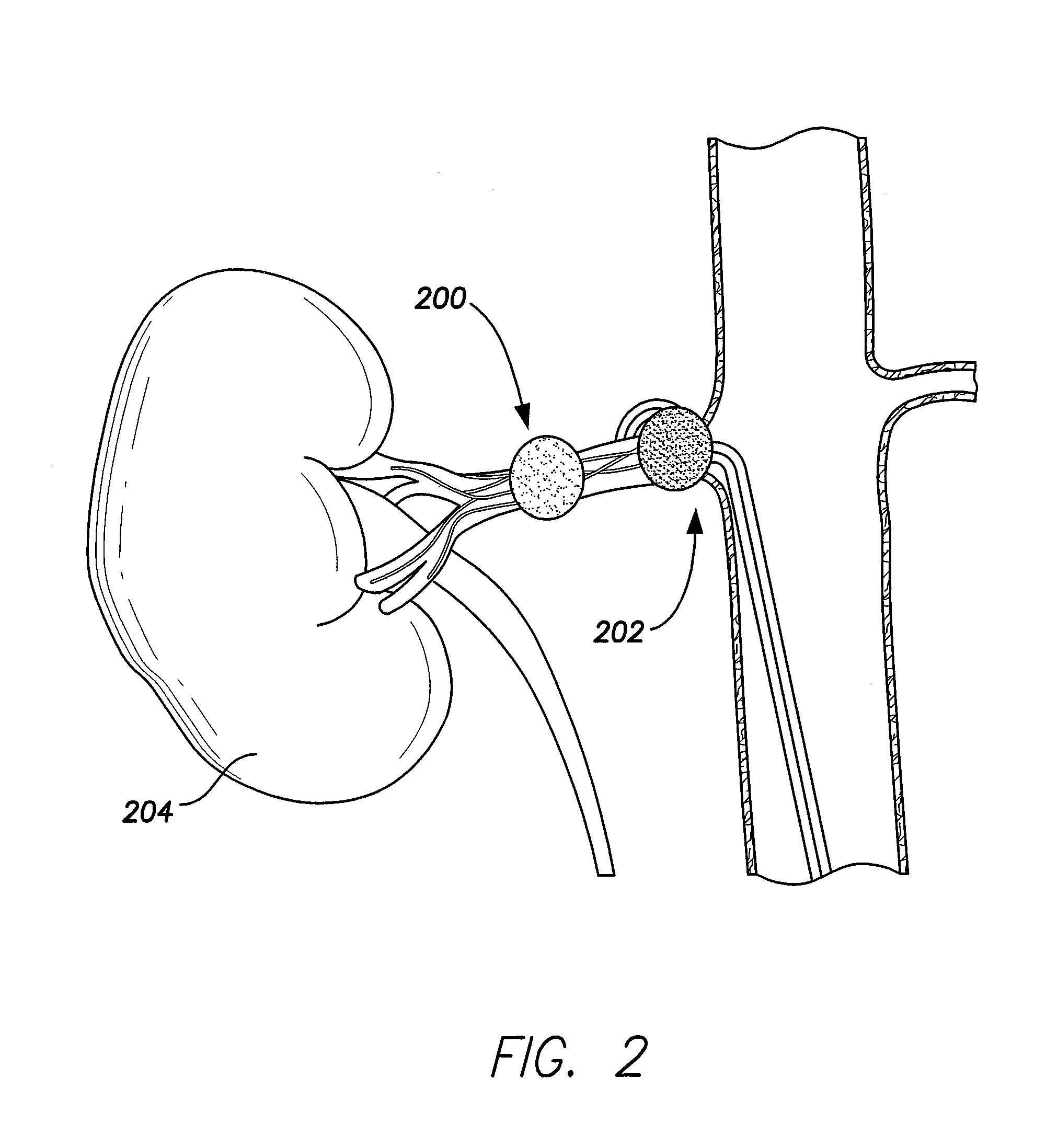 System and method for performing renal denervation verification