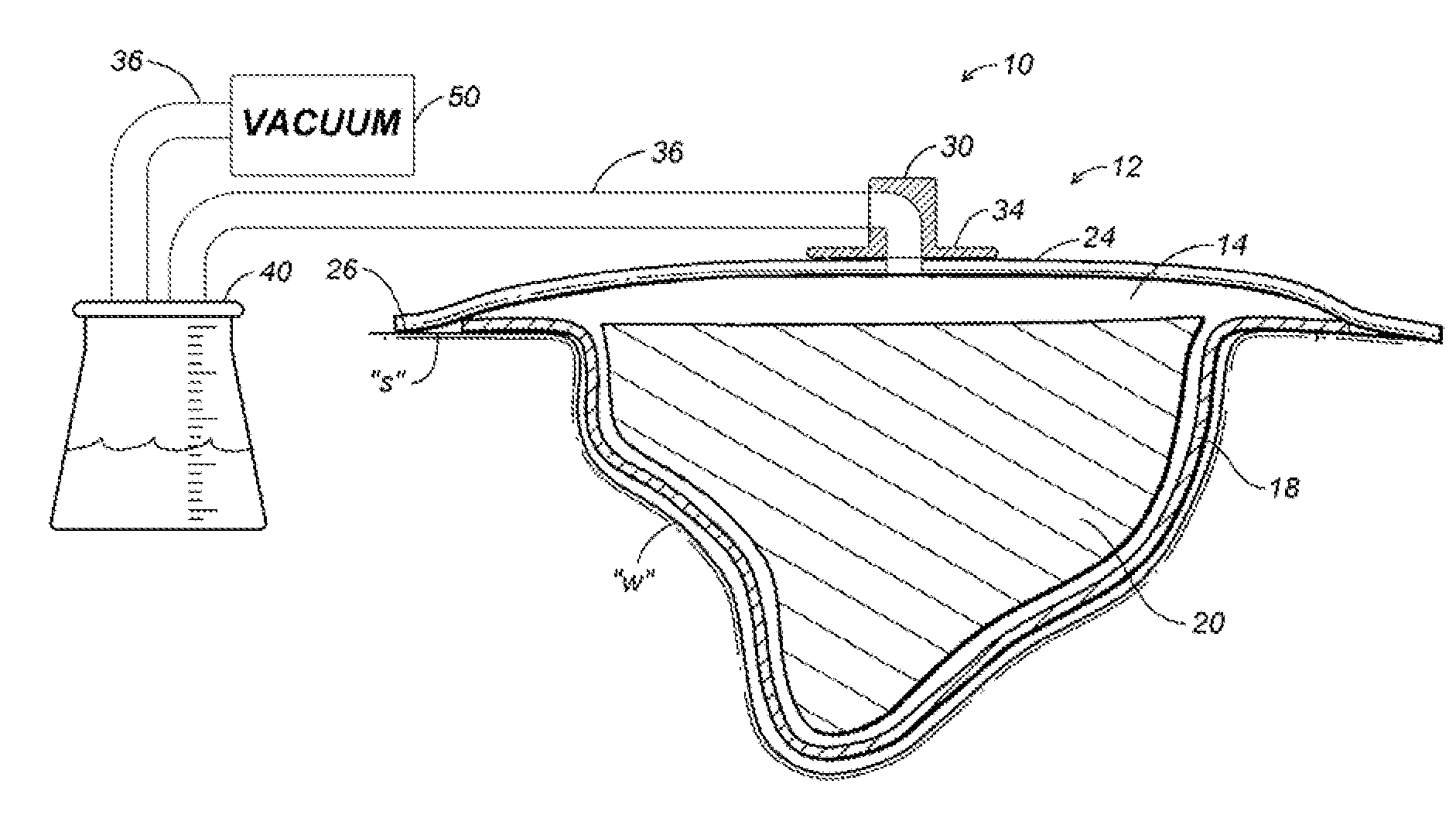 Thin film wound dressing