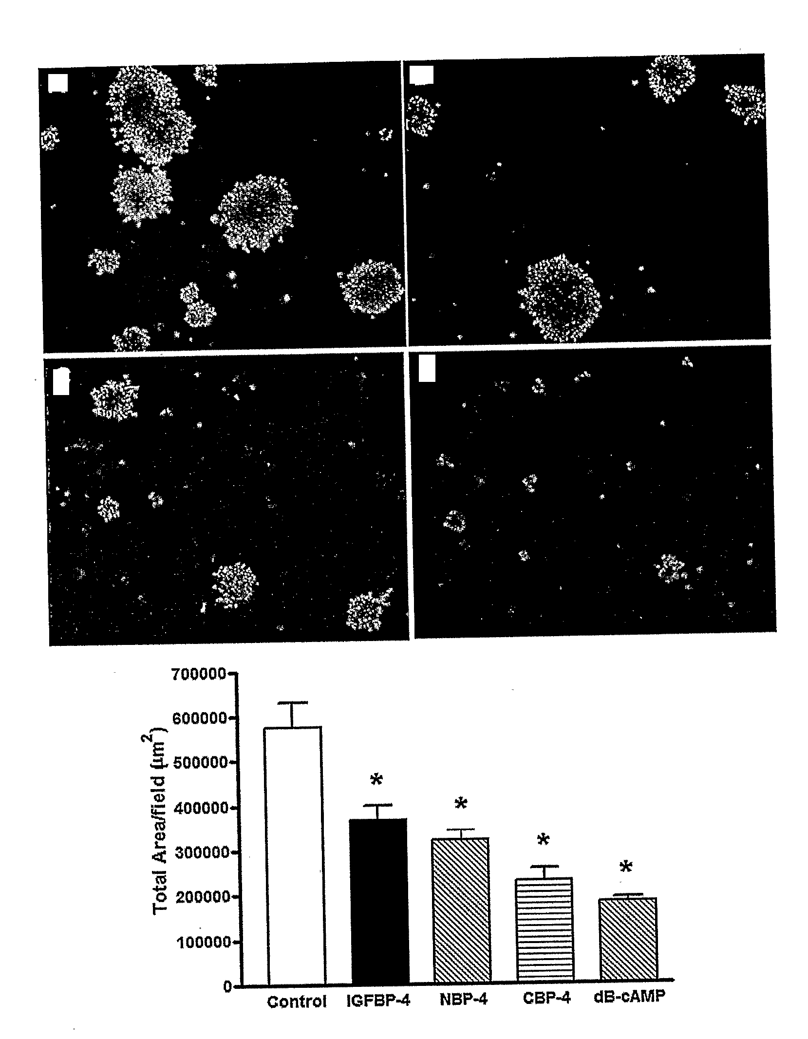 Insulin-Like Growth Factor Binding Protein-4 Compounds and Methods for Inhibiting Angiogenesis and Tumor Growth in Mammalian Cells