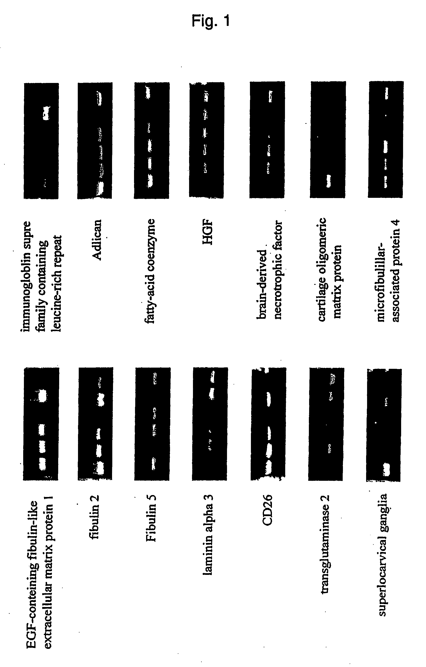 Marker for detecting mesenchymal stem cell and method of distinguishing mesenchymal stem cell using the marker