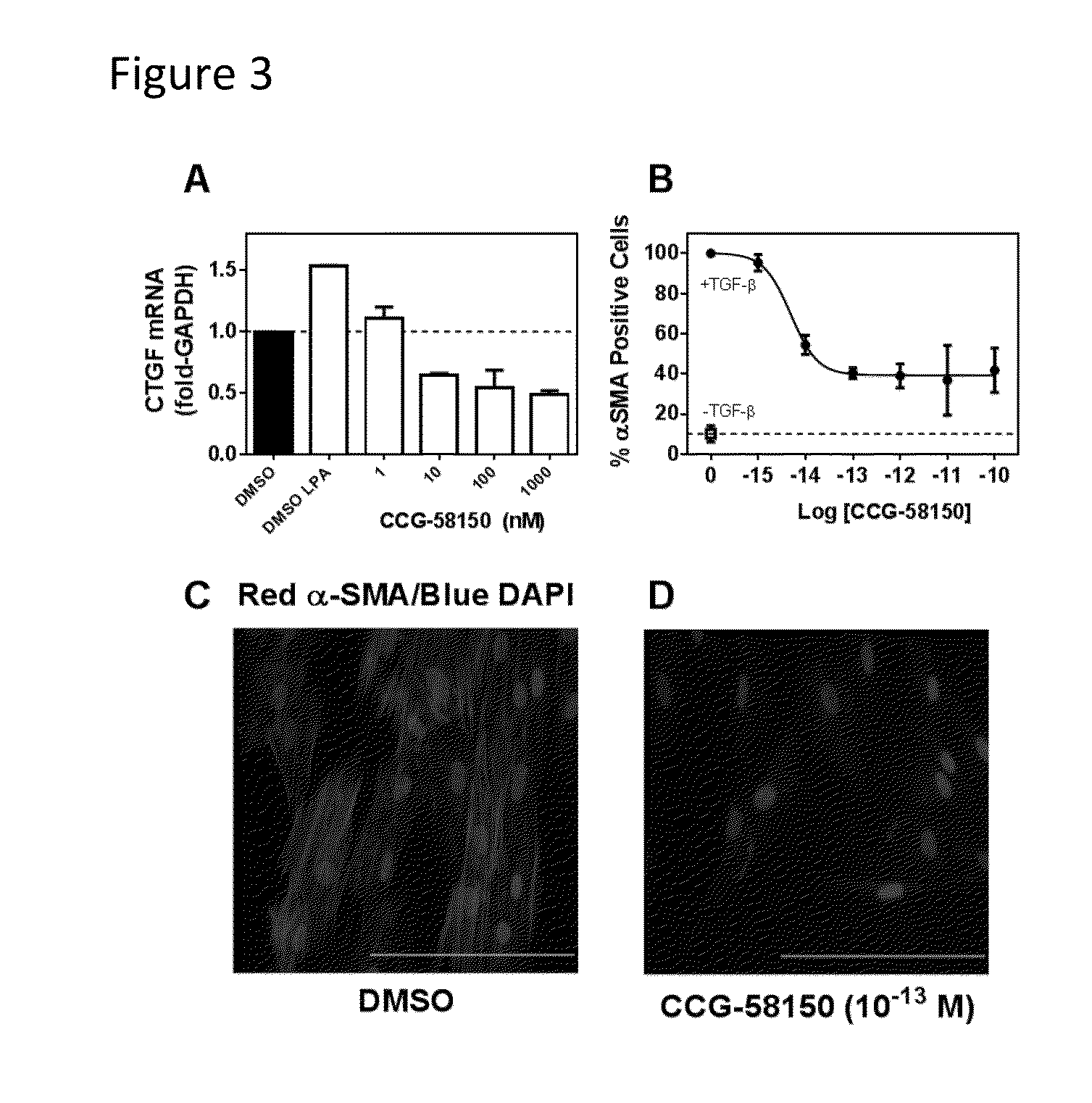 Methods and compositions for inhibiting rho/mrtf-mediated diseases and conditions