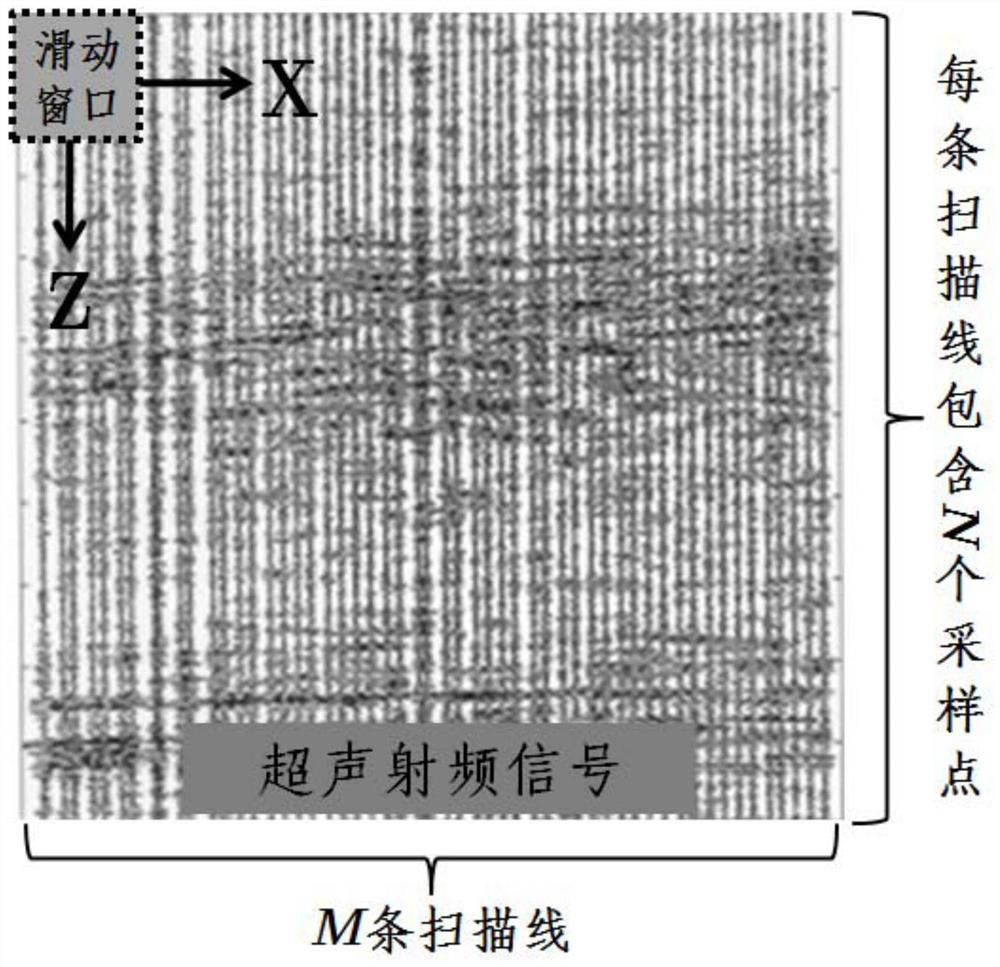 A Method of Ultrasonic Scattering Sub-diameter Imaging Based on Power Spectrum
