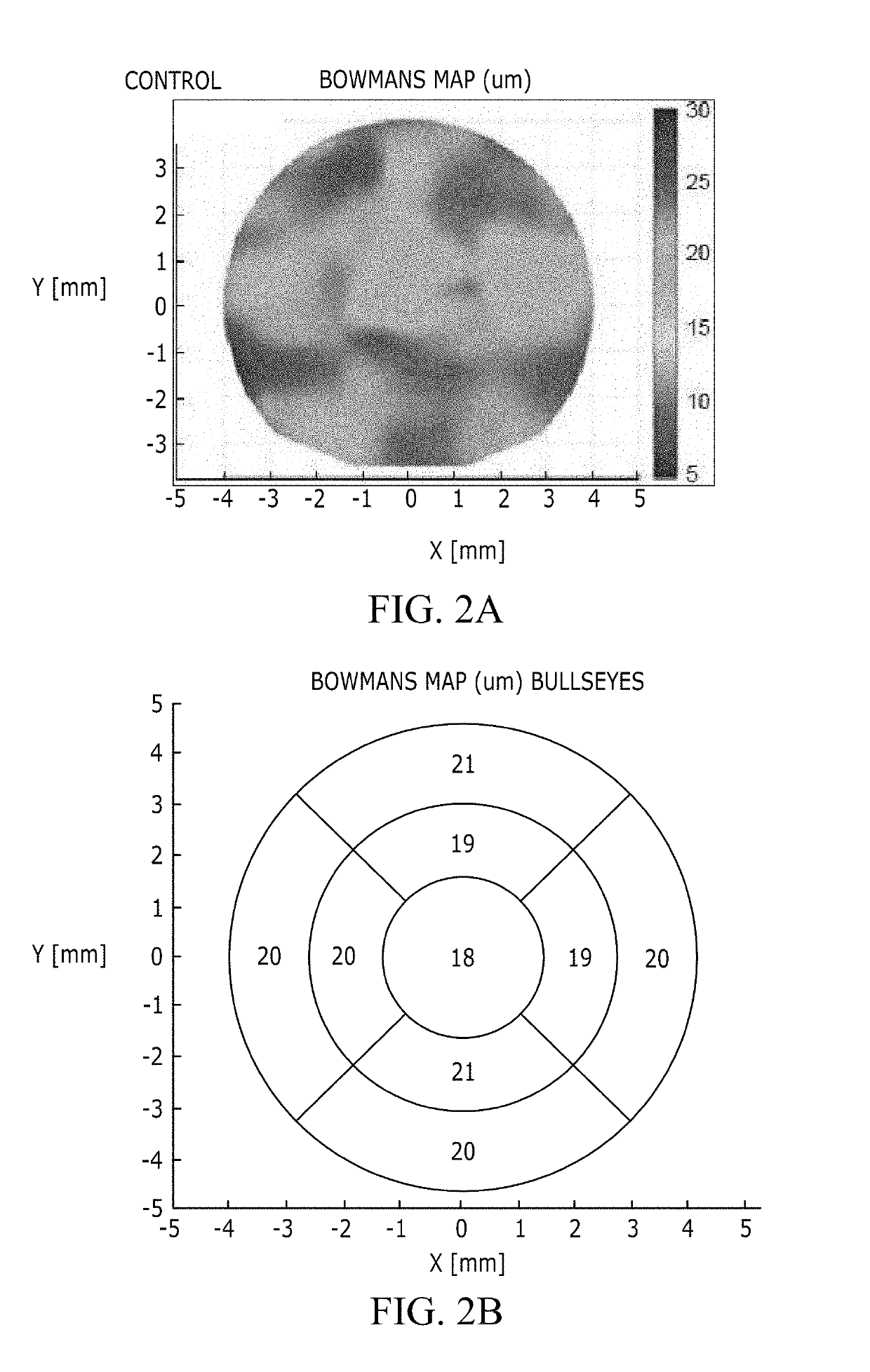 Method and system for three-dimensional thickness mapping of corneal micro-layers and corneal diagnoses