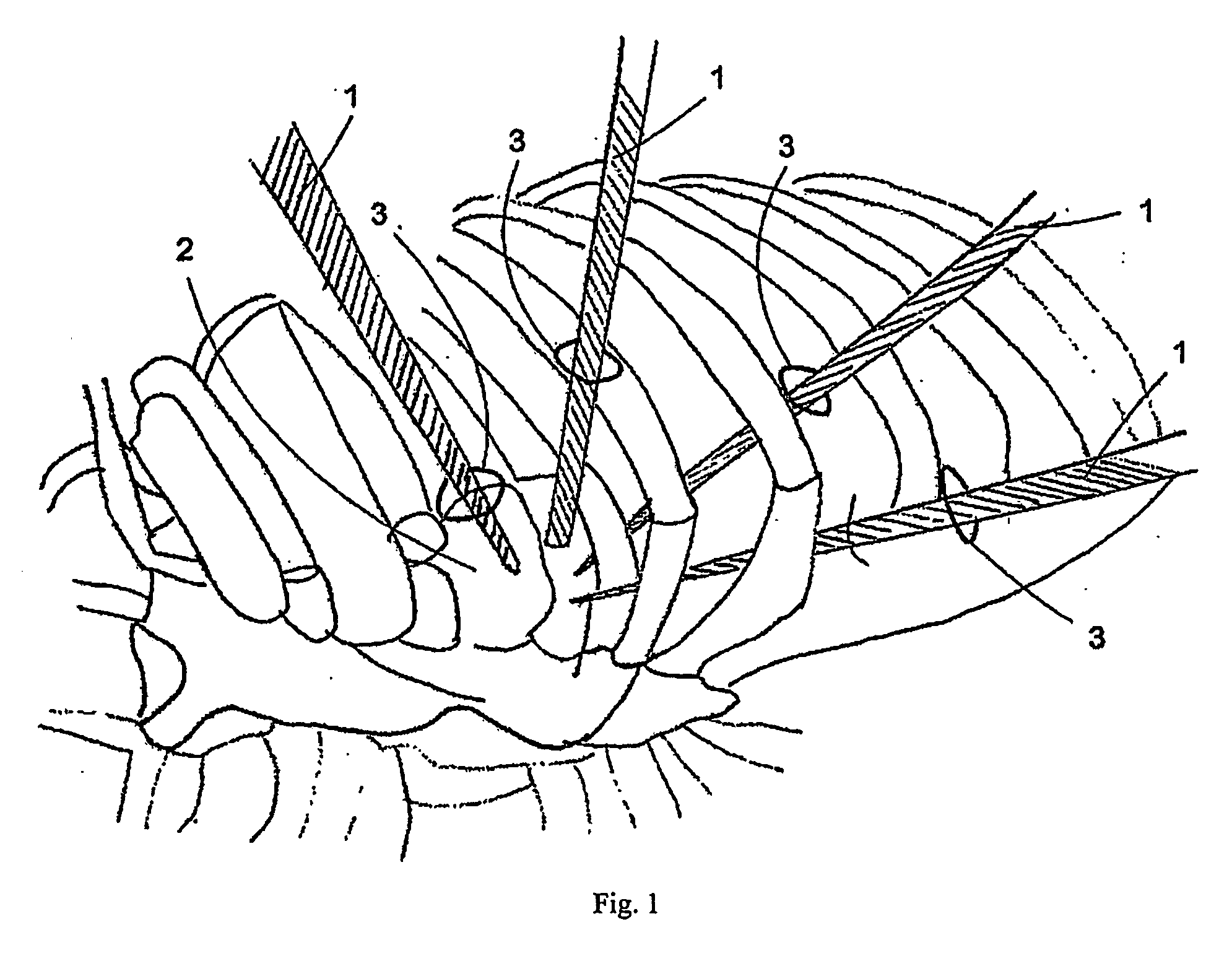 Force reflective robotic control system and minimally invasive surgical device
