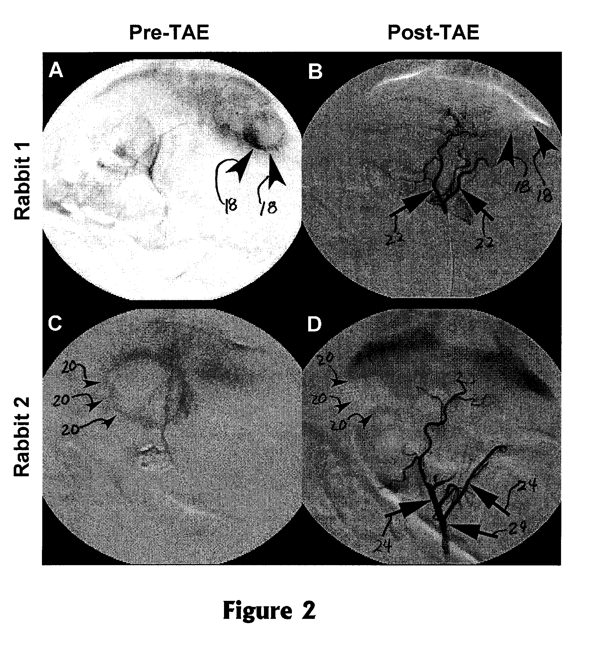 Method for transcatheter intra-arterial perfusion magnetic resonance imaging