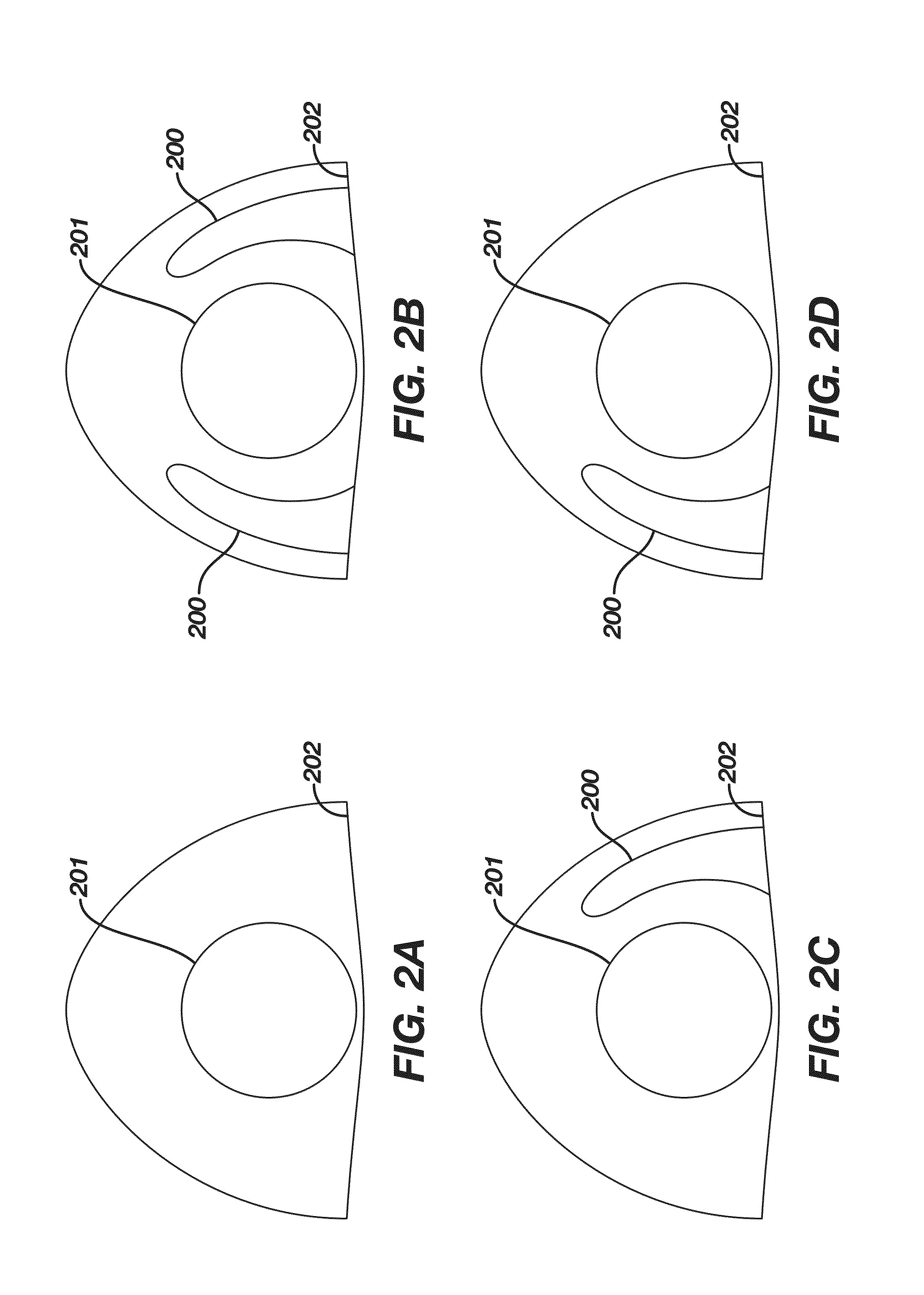 Method and apparatus of forming a translating multifocal contact lens having a lower-lid contact surface