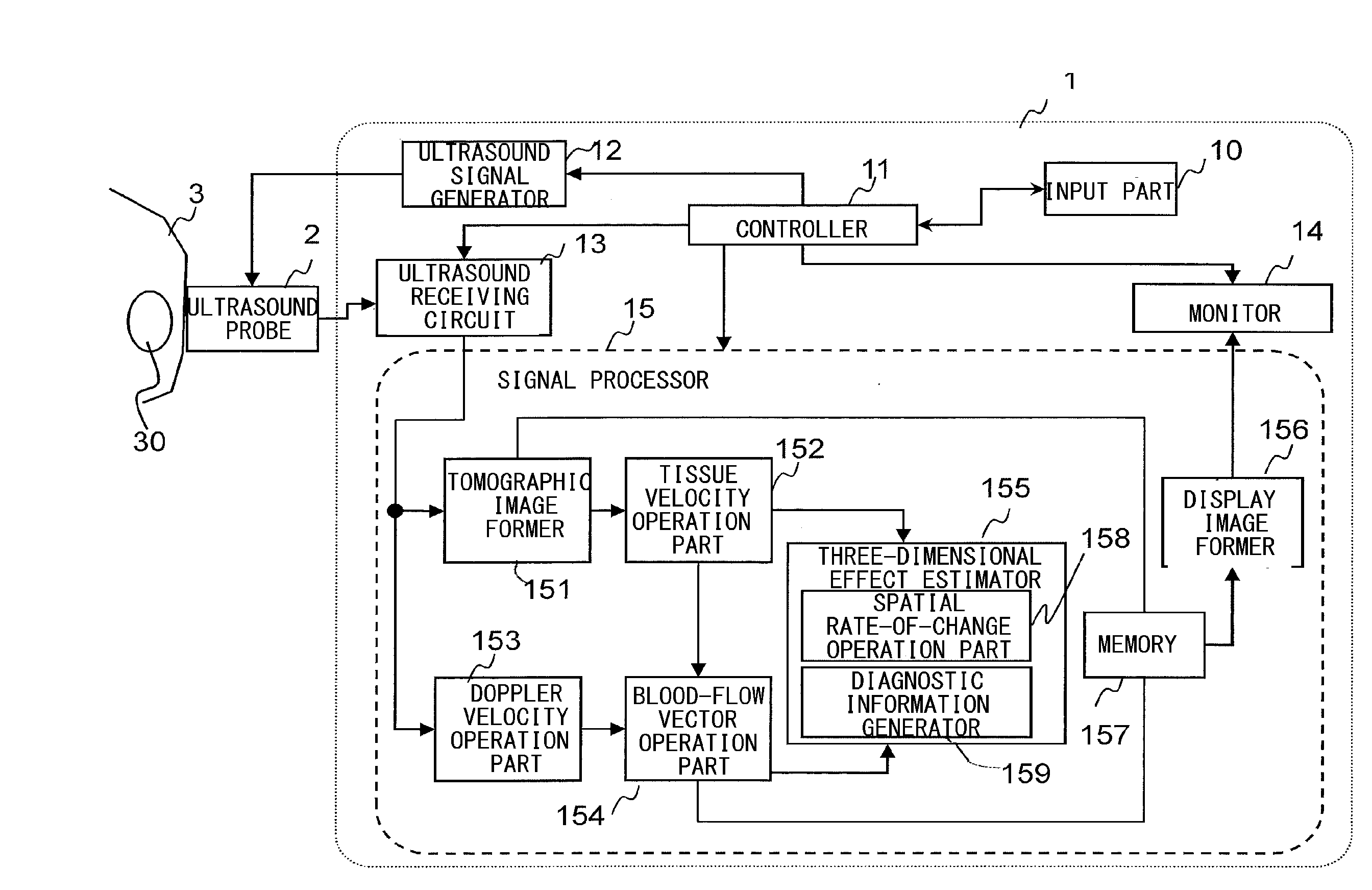 Ultrasonic image pickup device and method