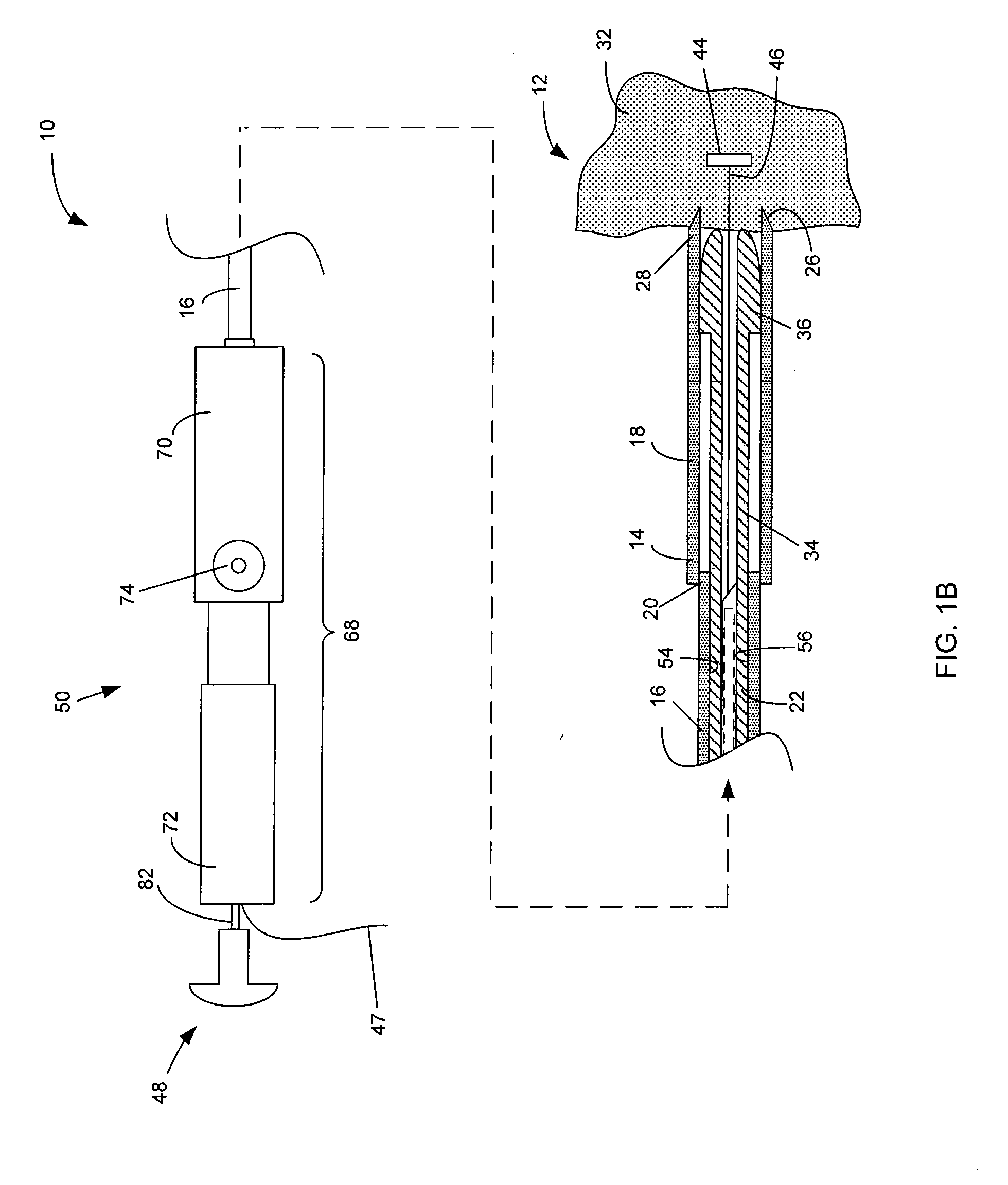 System and method for performing a full thickness tissue biopsy
