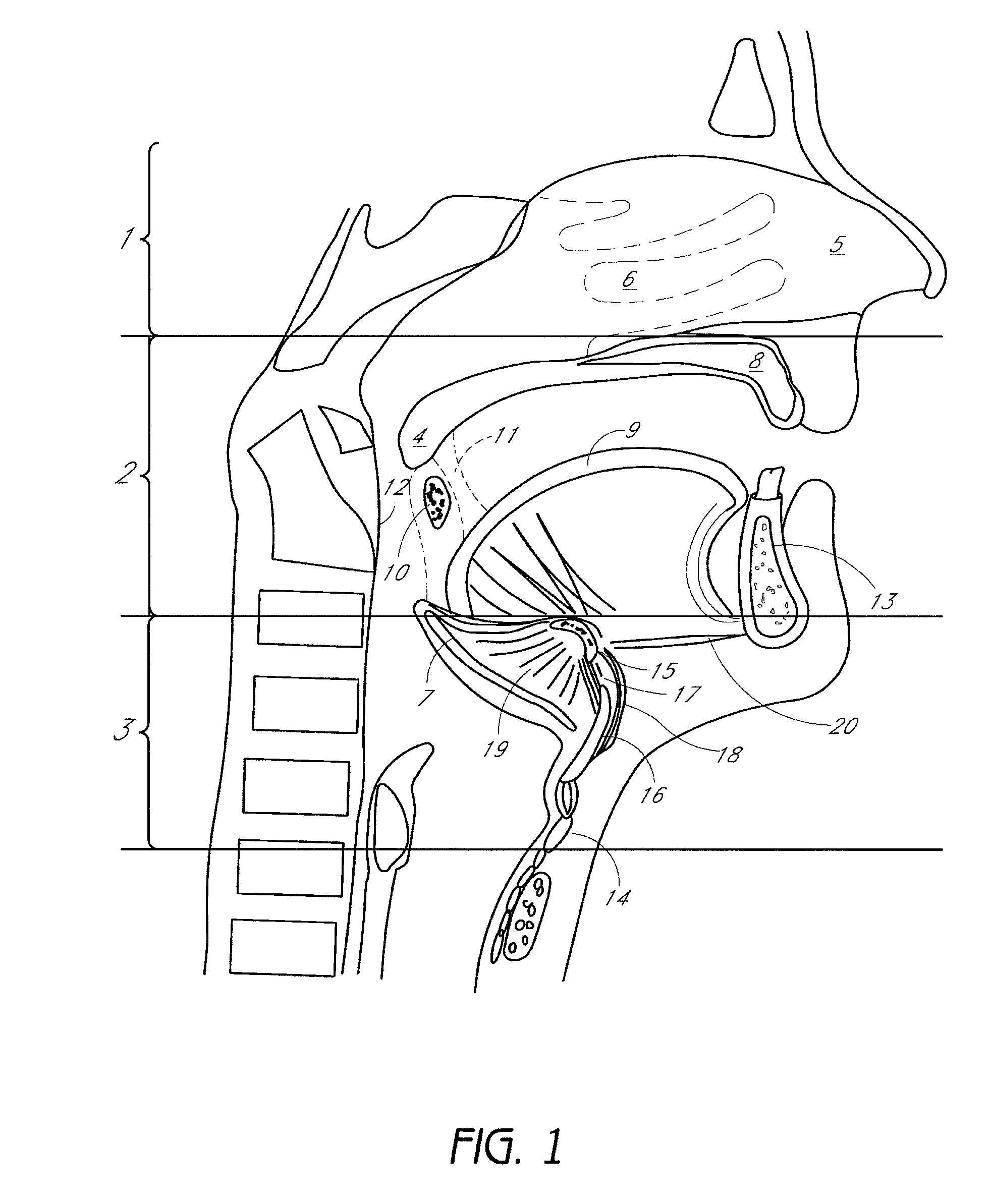 System and method for airway manipulation