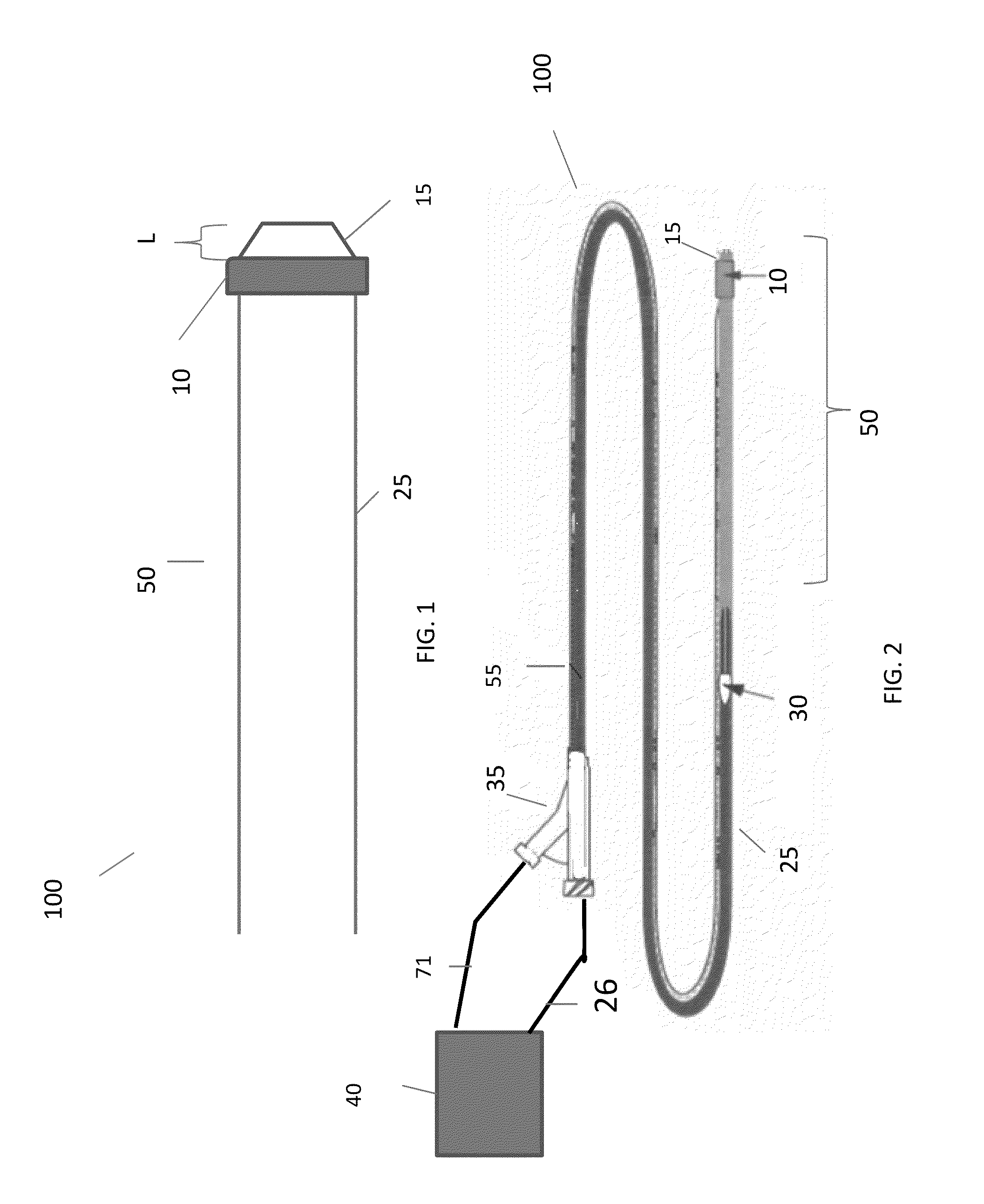 Implant delivery system and implants