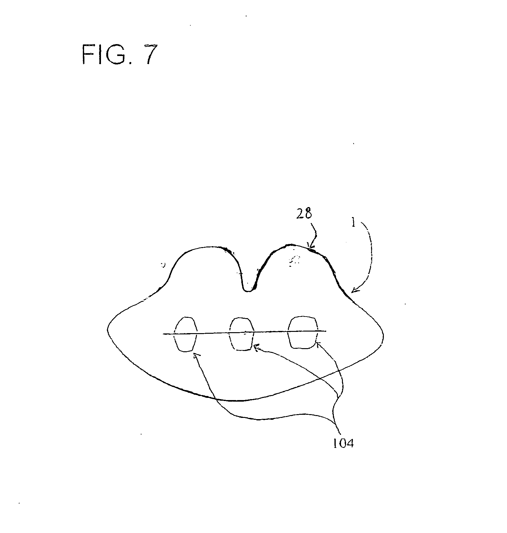 Appliance, system and method for preventing snoring