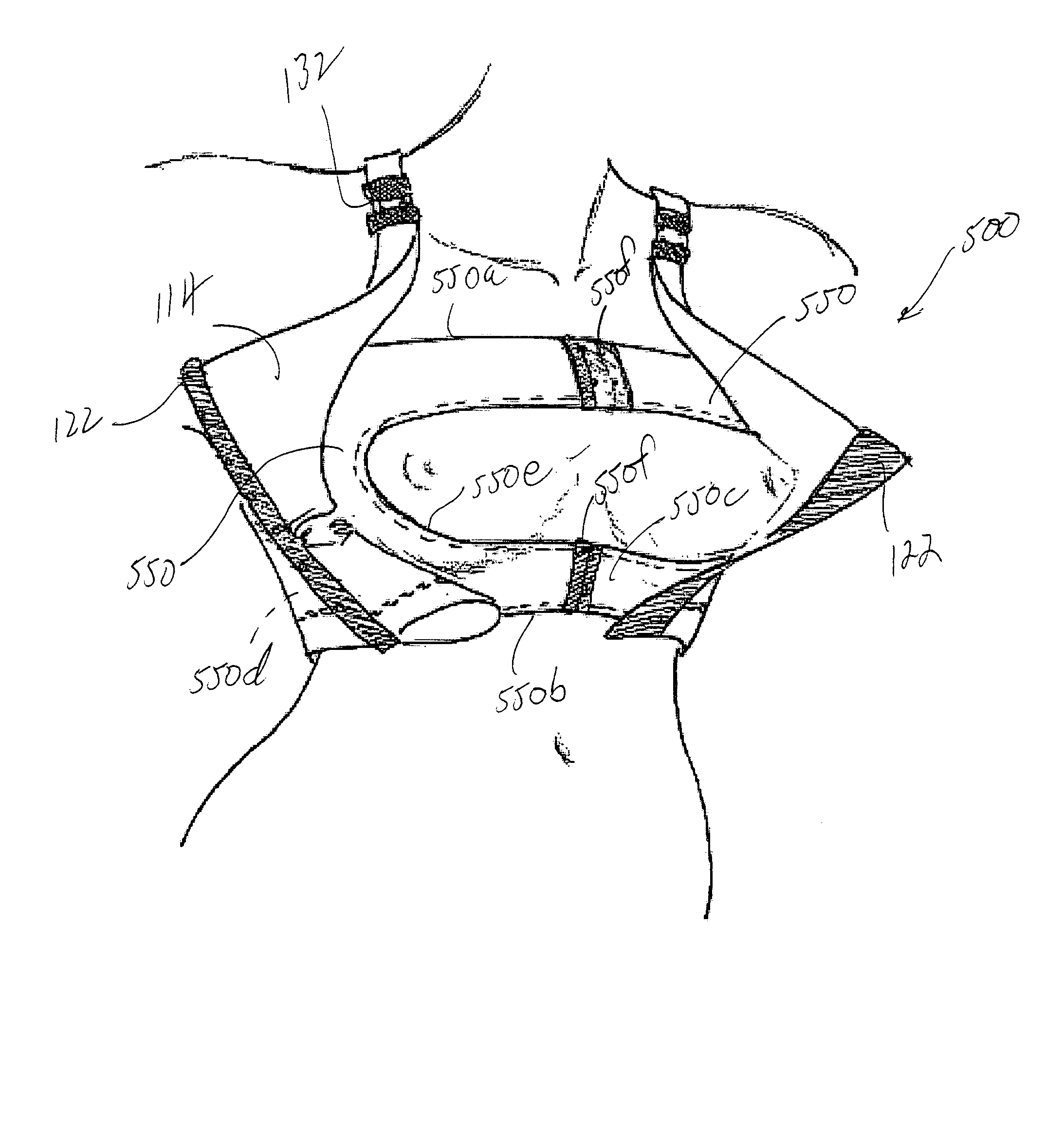 Garment with breast implant stabilizers