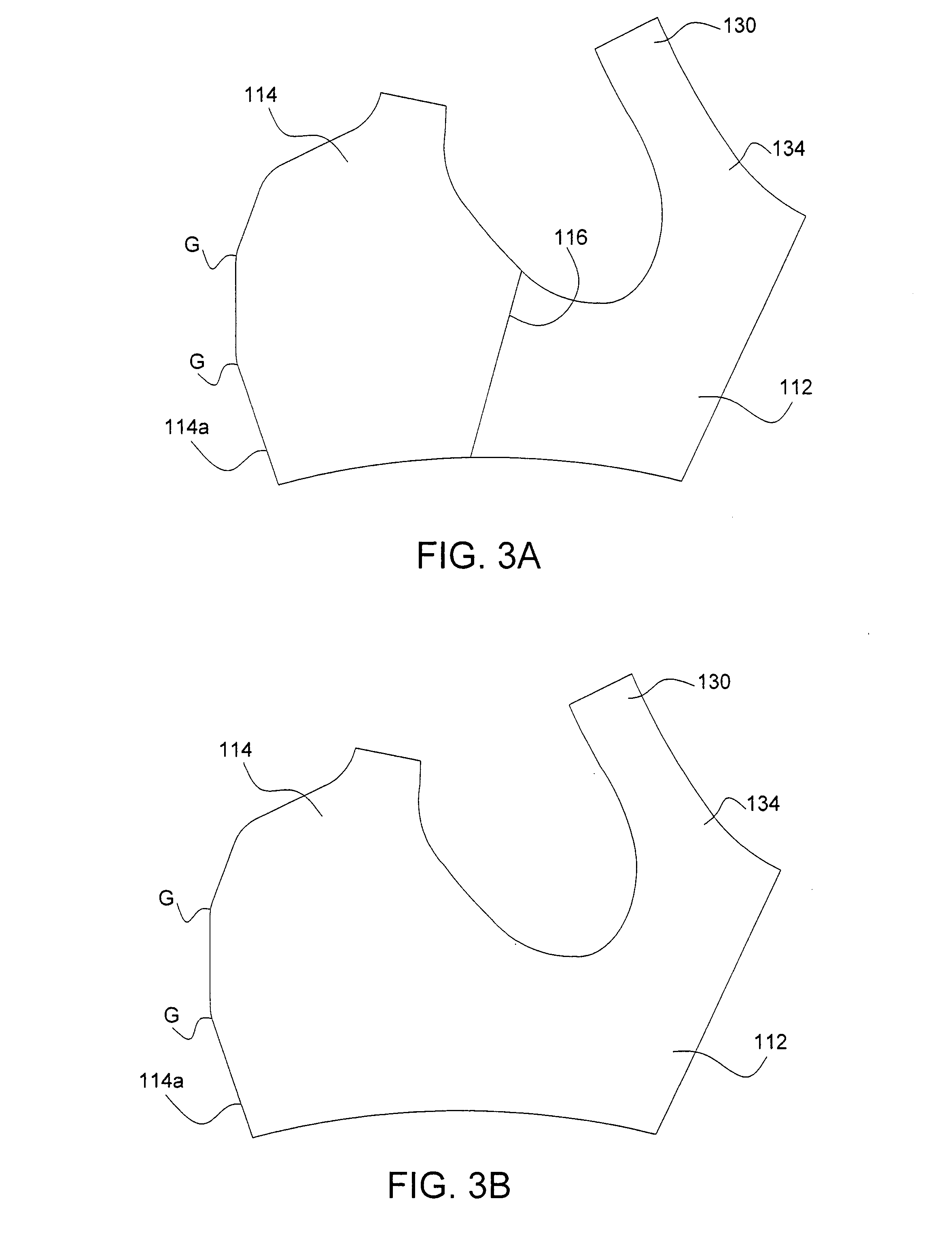 Garment with breast implant stabilizers
