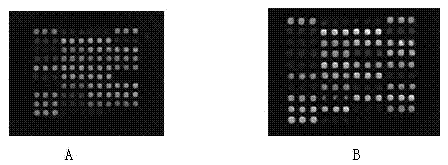 Gene chip for detecting mutation of 18 loci of susceptibility genes of type 2 diabetes