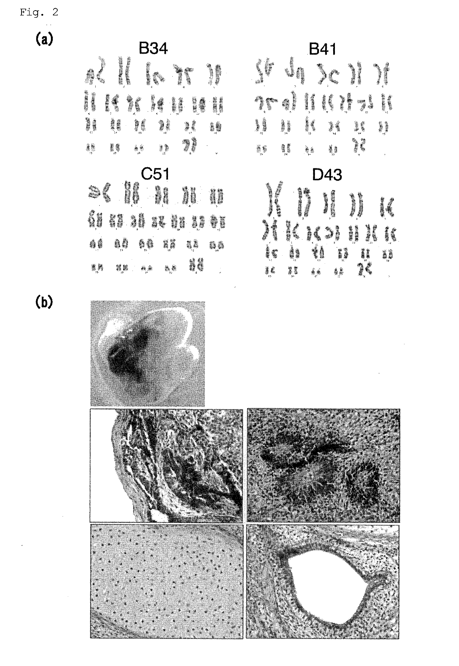 iPS CELL HAVING DIFFERENTIATION PROPENSITY FOR CORNEAL EPITHELIUM