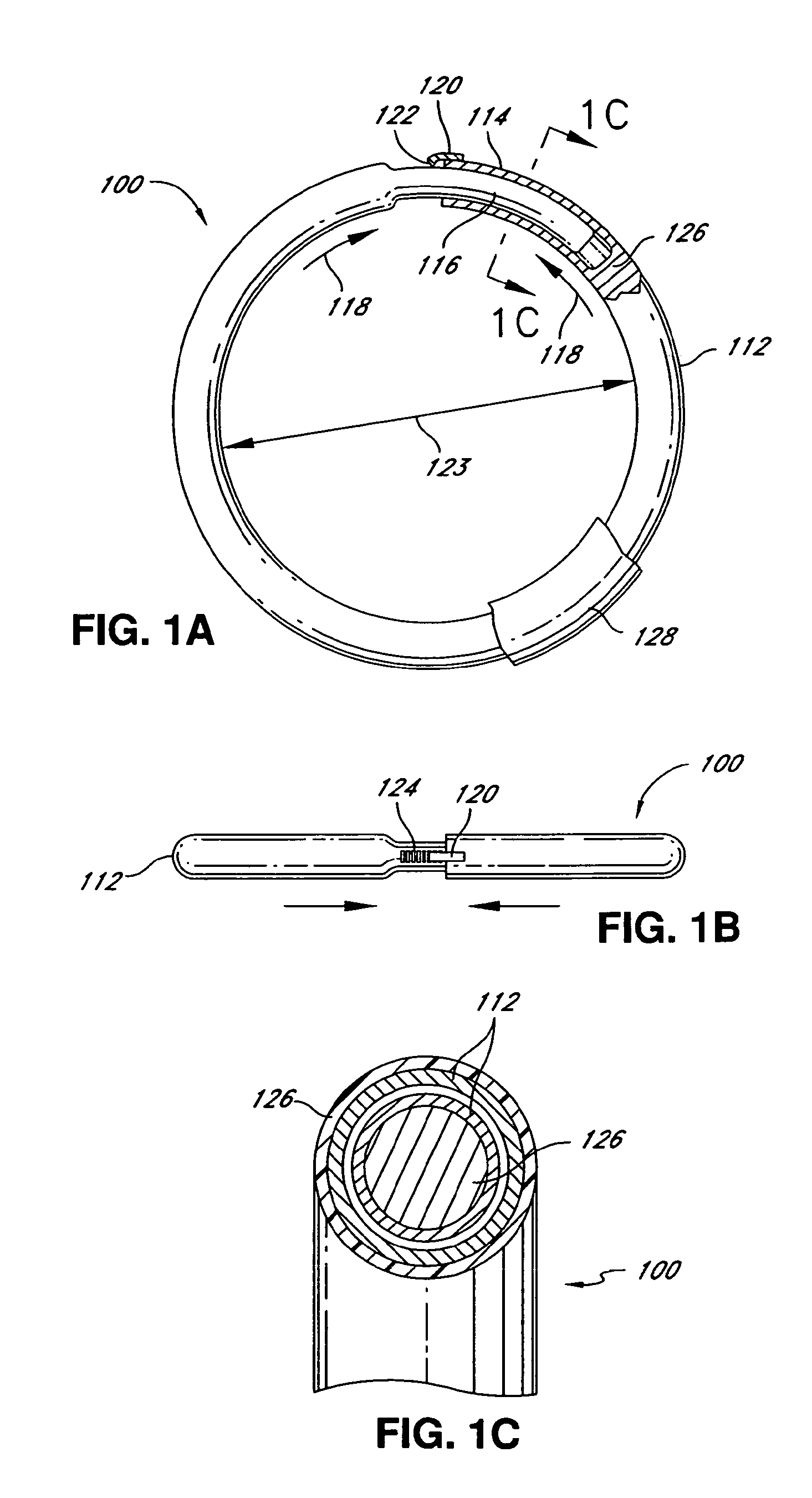 Adjustable annuloplasty ring activation system