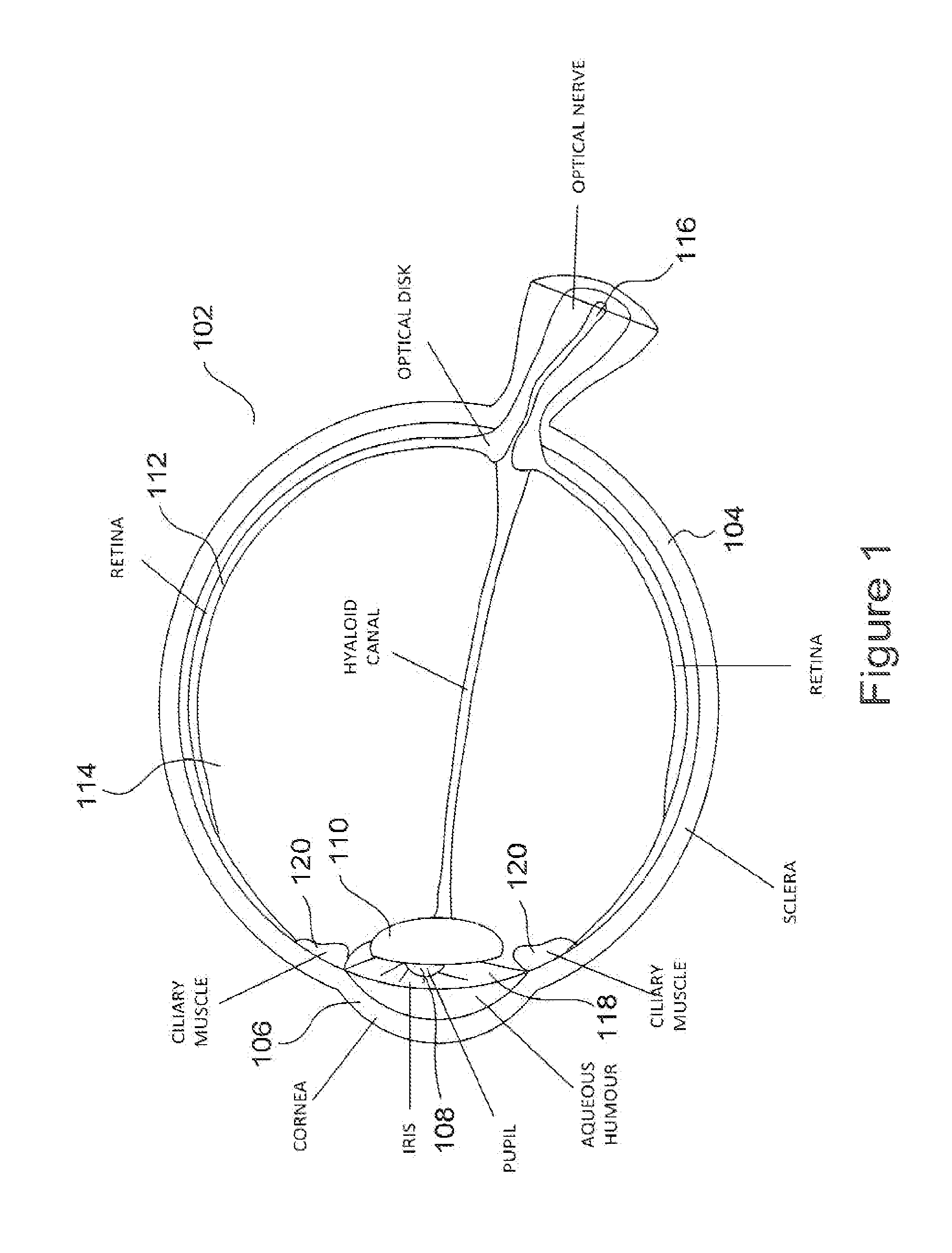 Method and apparatus for limiting growth of eye length