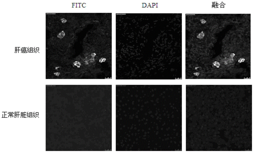 Anti-liver cancer stem cell monoclonal antibody and its application