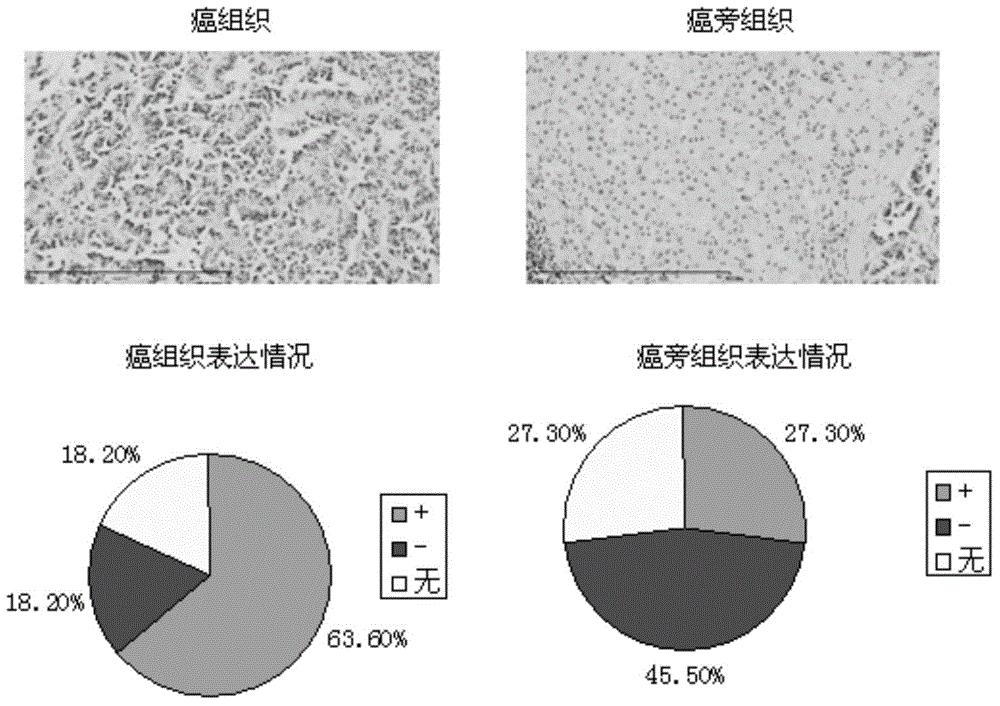 Anti-liver cancer stem cell monoclonal antibody and its application