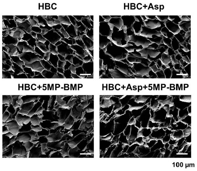 Drug-loaded bone repair material as well as preparation method and application thereof