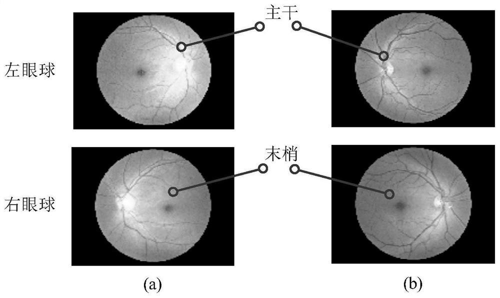 Fundus blood vessel image segmentation method based on self-supervised learning