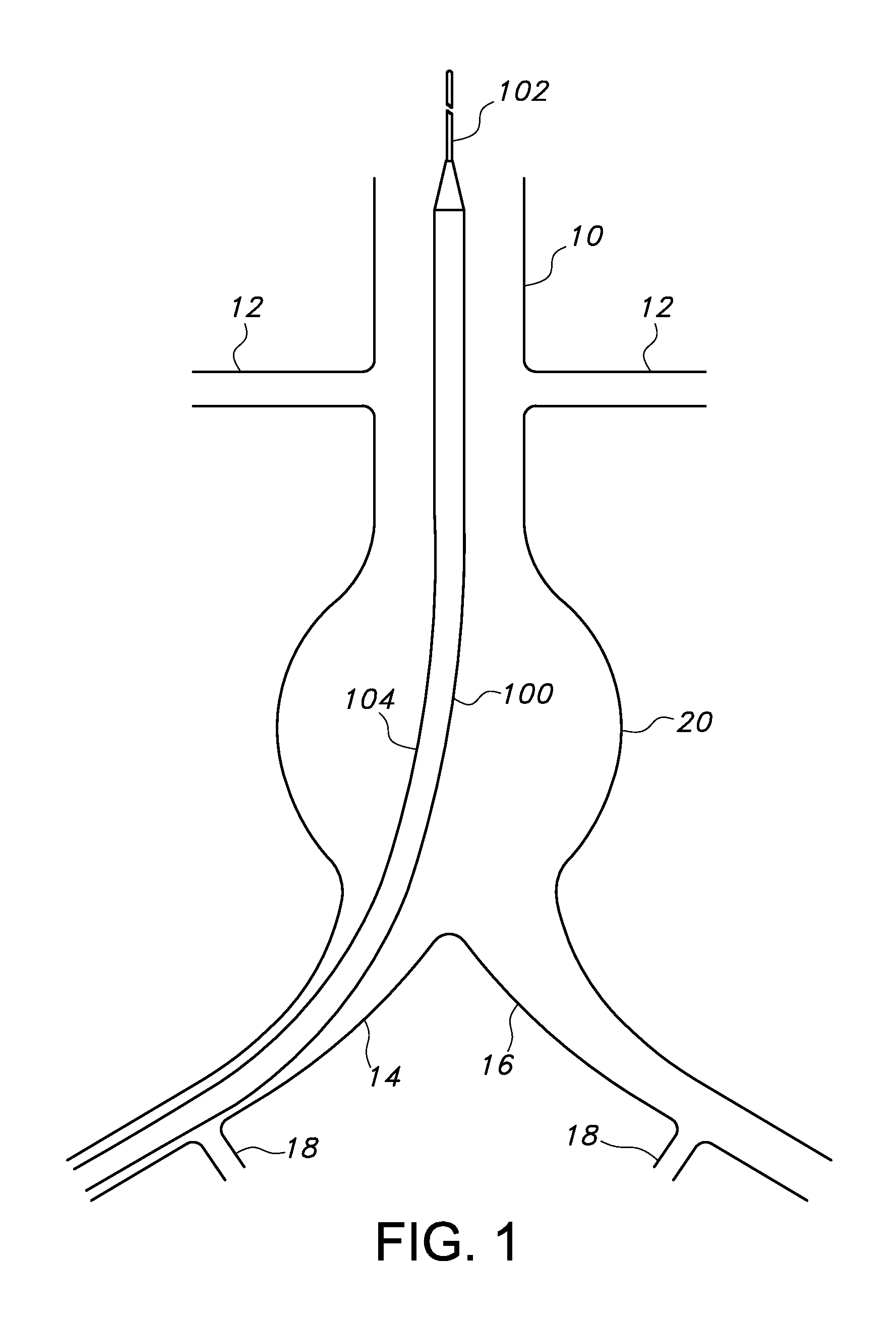 Endovascular delivery system with an improved radiopaque marker scheme