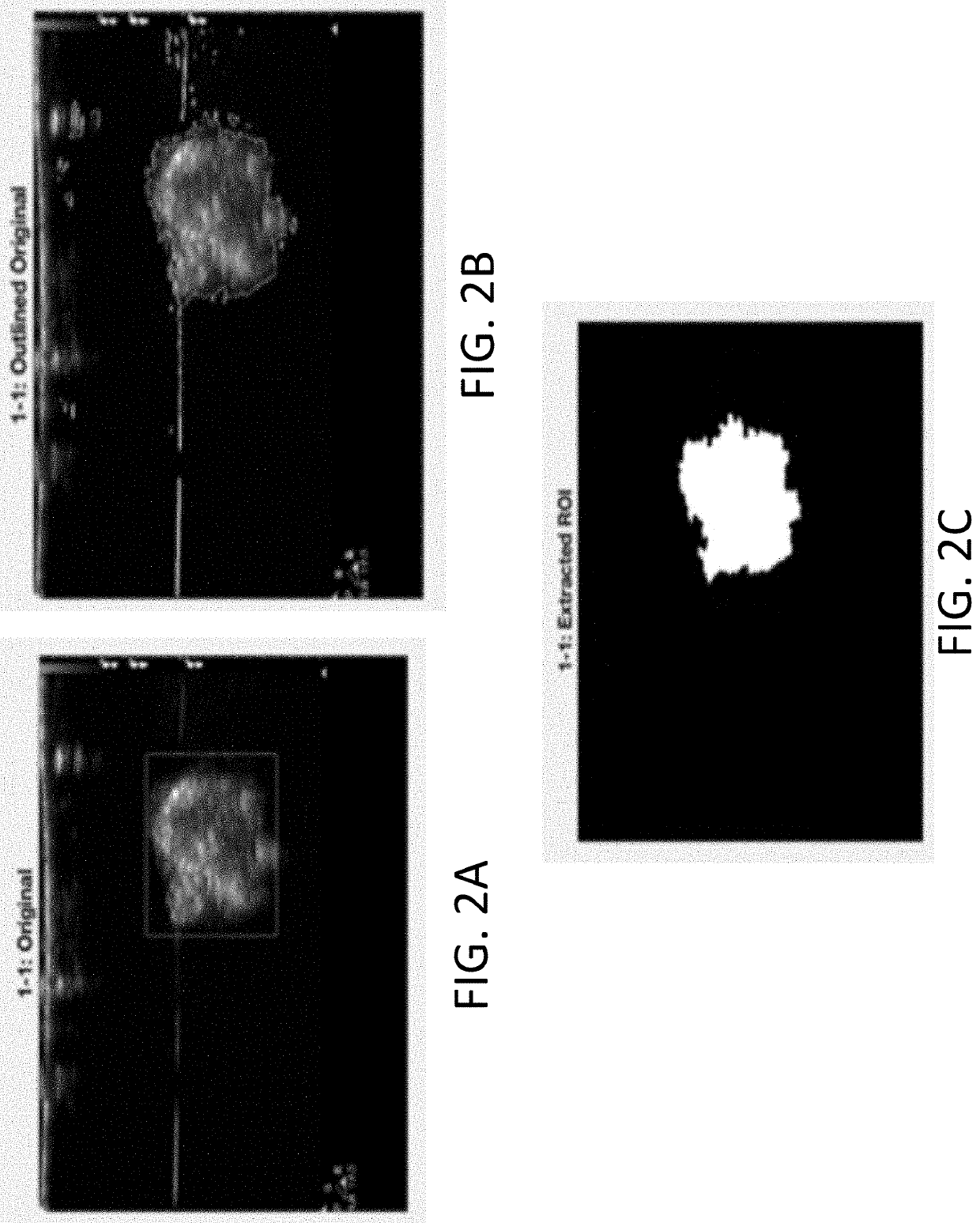 Systems and methods for automated image recognition of implants and compositions with long-lasting echogenicity