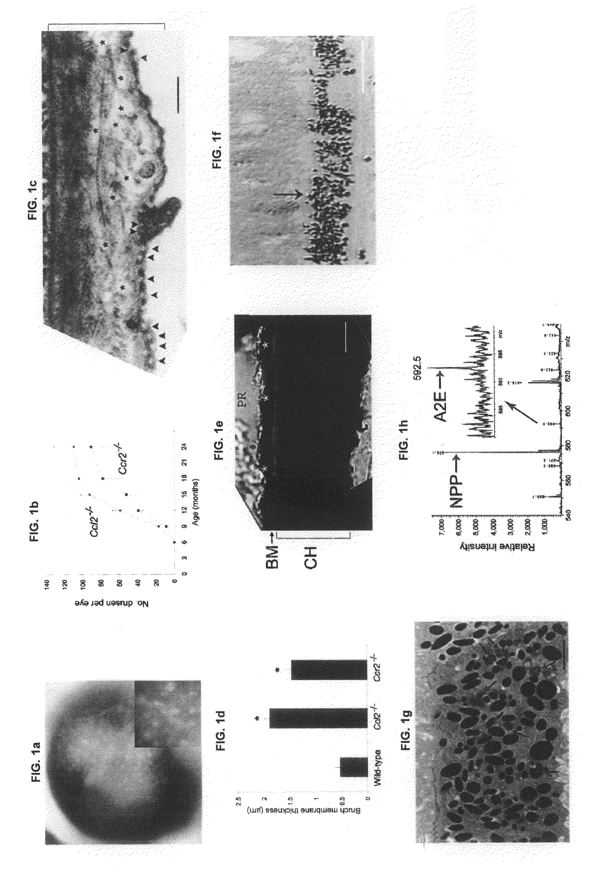 Methods and animal model for analyzing age-related macular degeneration
