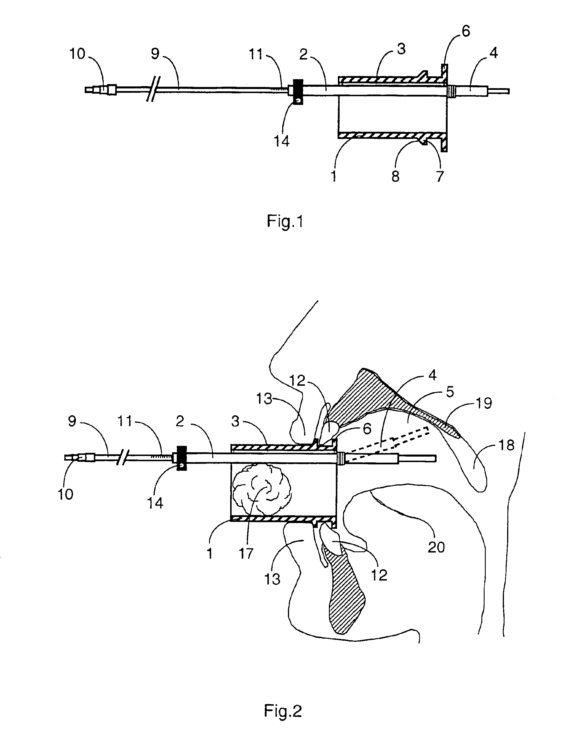 Mouthpiece intended for a device used to assess the sensitivity of the pharynx and a device comprising same