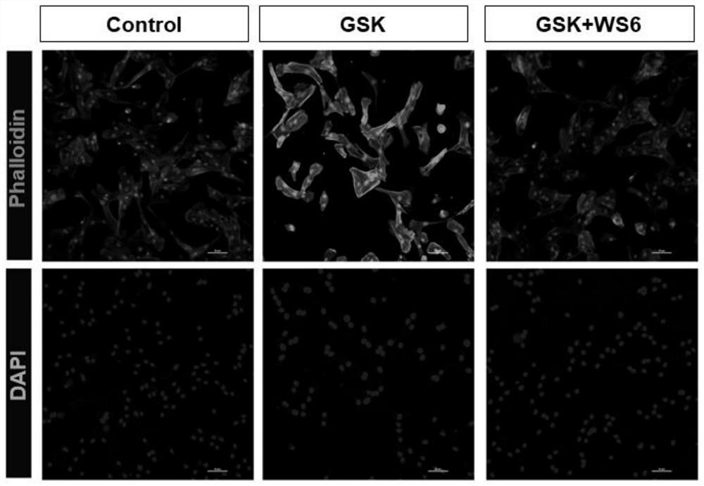 Effect of ws6 on actin formation in trabecular meshwork cells