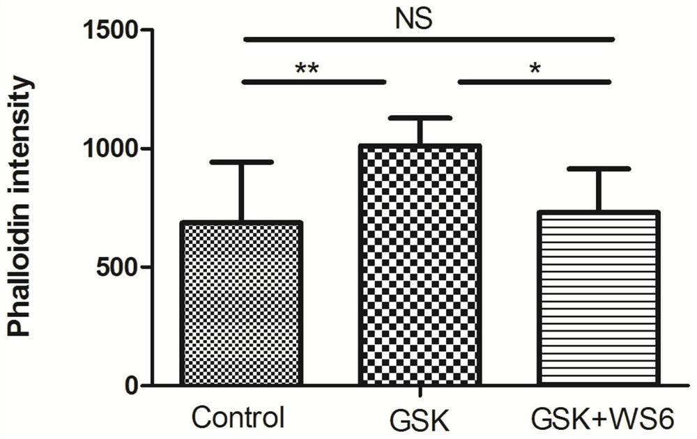 Effect of ws6 on actin formation in trabecular meshwork cells