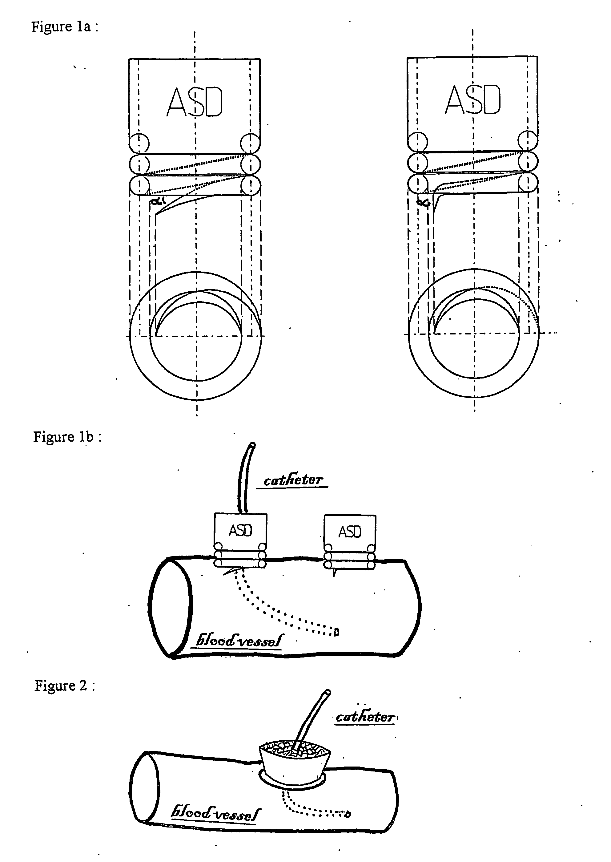 Anchoring screw device